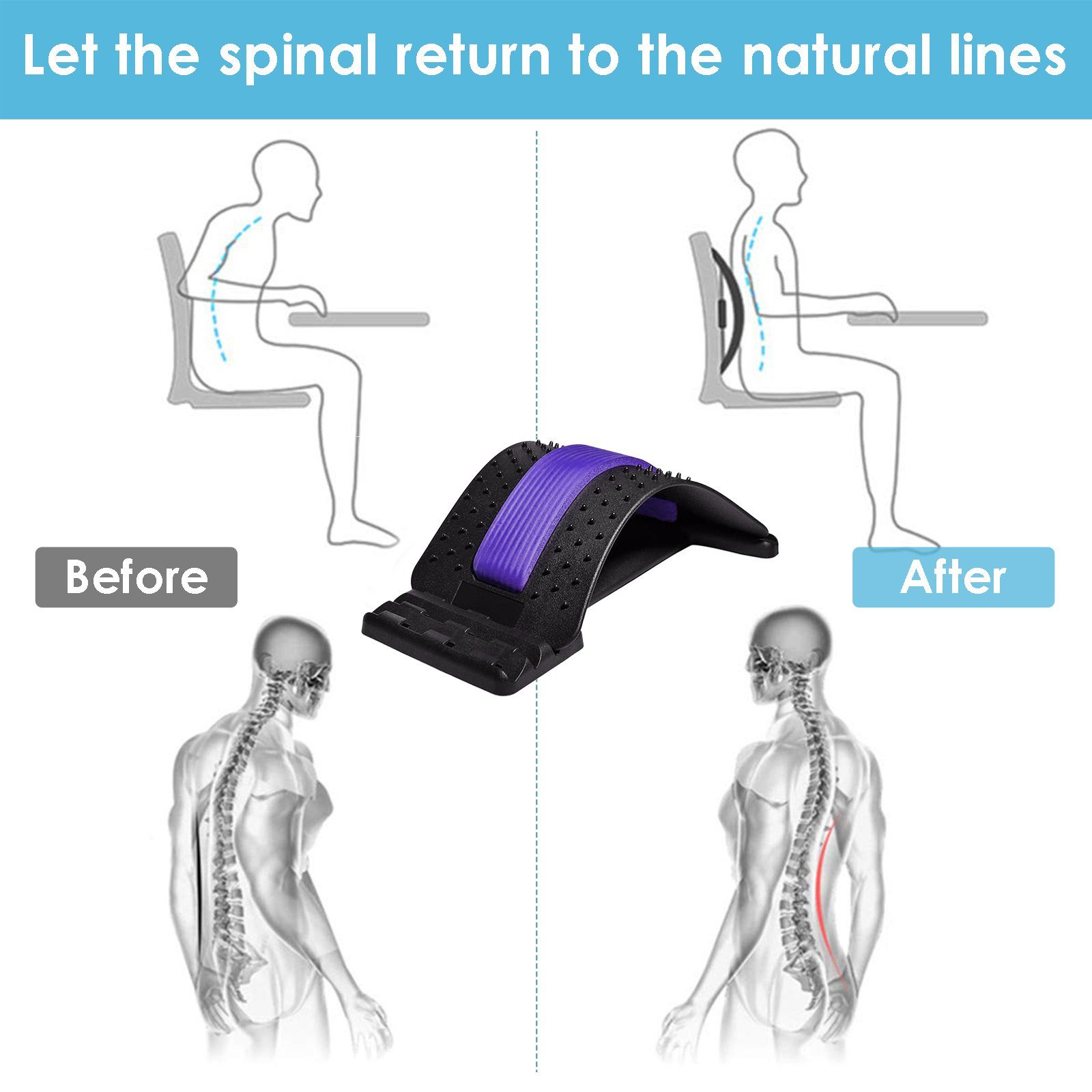 (1-tlg), Rückenstrecker Design Trainer Rückentrainer Korrektor Rückenschmerzlinderung Einstellbar/Bogenstützende Lospitch Rückentrainer,