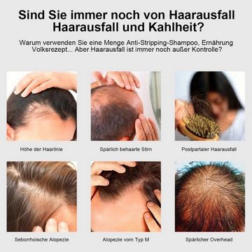 LENBEST Haarbürsten-Set Haarbürste 6W Massage Haarkamm mit EMS-Mikrostrom, 1-tlg., RF-Radiofrequenz,EP-Technologie