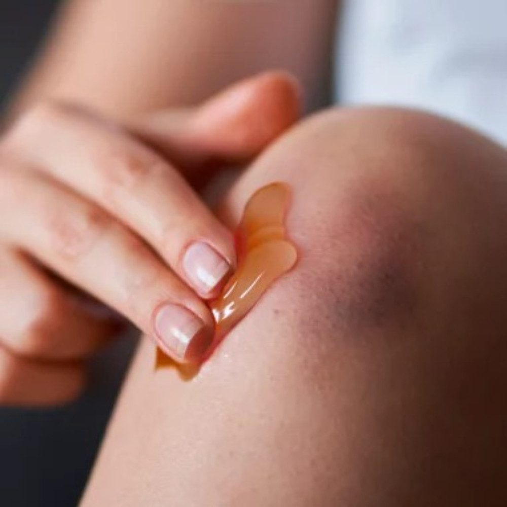 propolia Hautpflegegel SOS Skin Care Gel Propolis & Arnica für Prellungen & Hautregeneration, 1-tlg., Natürliches Wundpflege Gel mit Arnica & Propolis- beruhigt Haut sofort