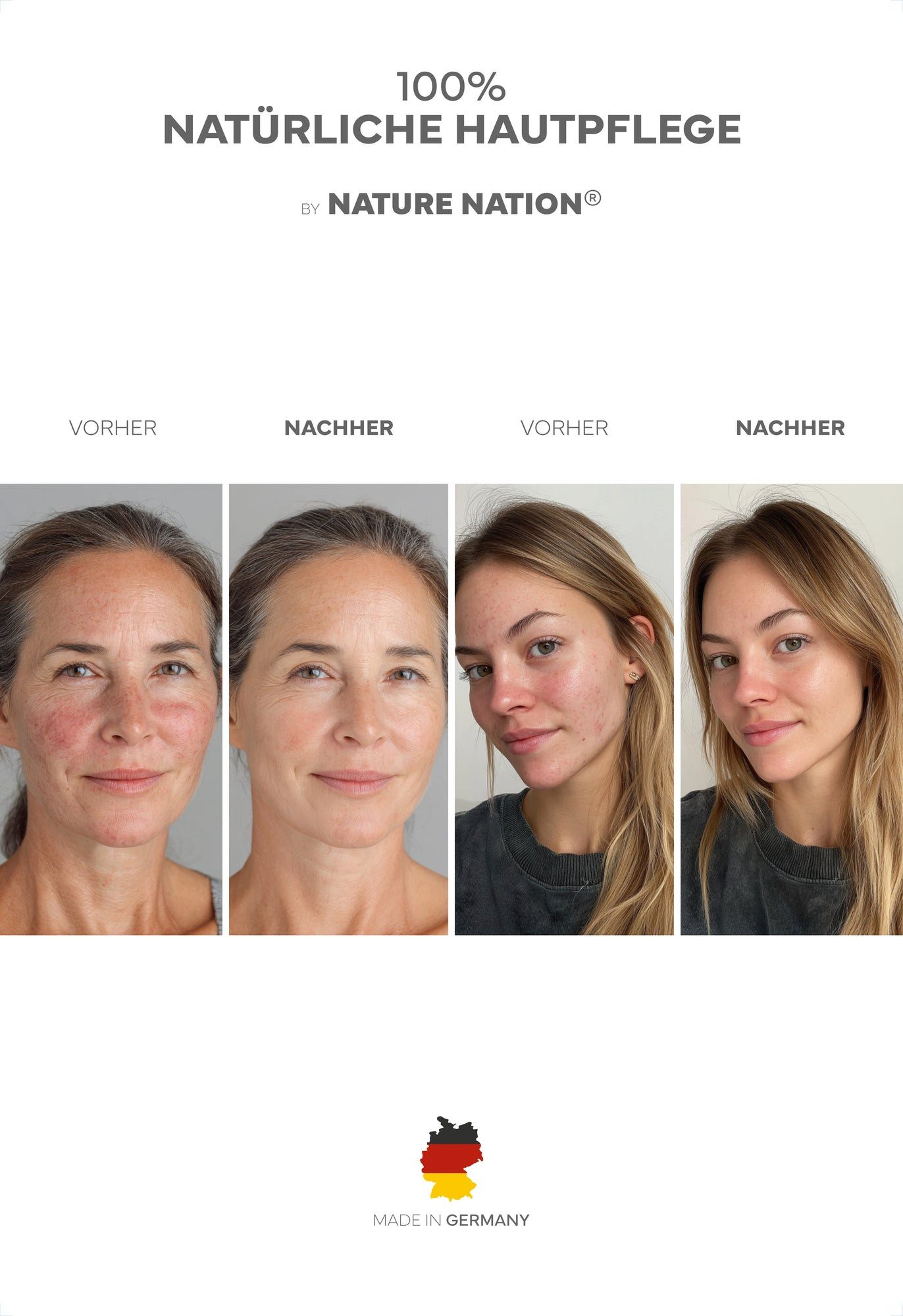 NATURE NATION Körperpflegemittel Tallow Rindertalg Creme 120ml – natürliche Hautpflege Packung