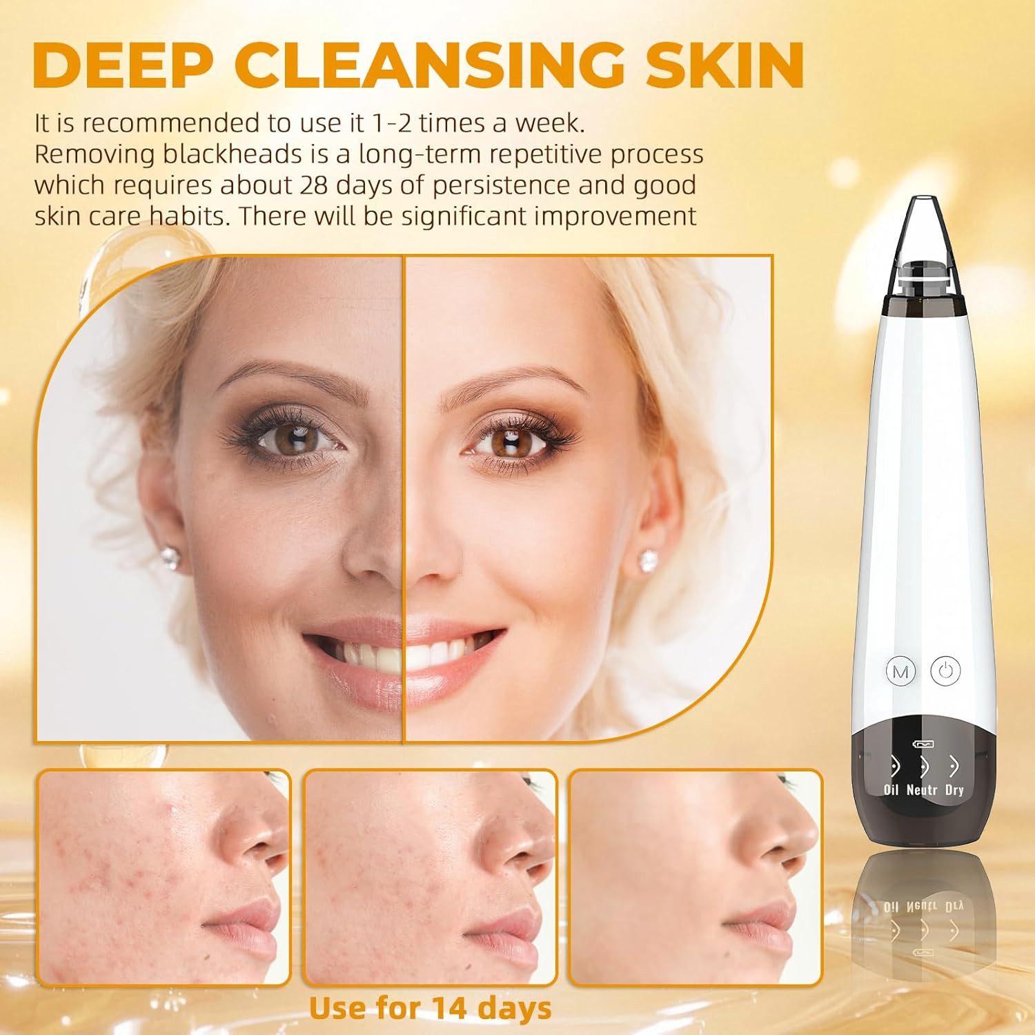 Toomoke Porenreiniger Porenreiniger,Mitesserentferner,Porensauger,6 Saugköpfen, Gesichtsporenreiniger, Tiefenreinigung,USB-aufladbar, weiß,Komedonen-Extraktor, Vakuum Beauty Hautpflegegerät mit 3 Modi,für Verschiedene Hauttypen