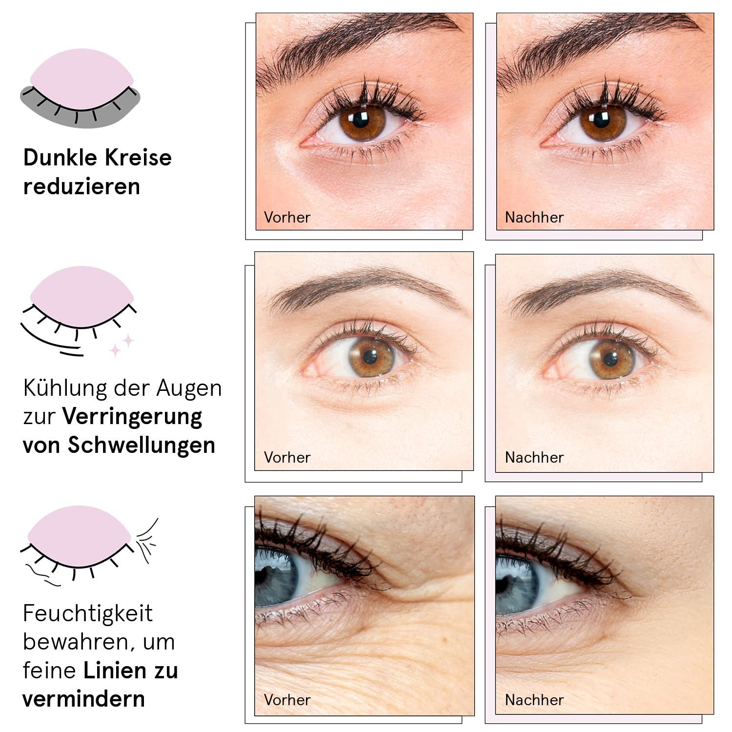 grace & stella Augenpads Preisgekrönte Augenpads (24 Paare, Gold), 24-tlg., Unterstützt ein glatteres und strahlenderes Hautbild, Hilft, Augenringe, Tränensäcke und Schwellungen optisch zu reduzieren