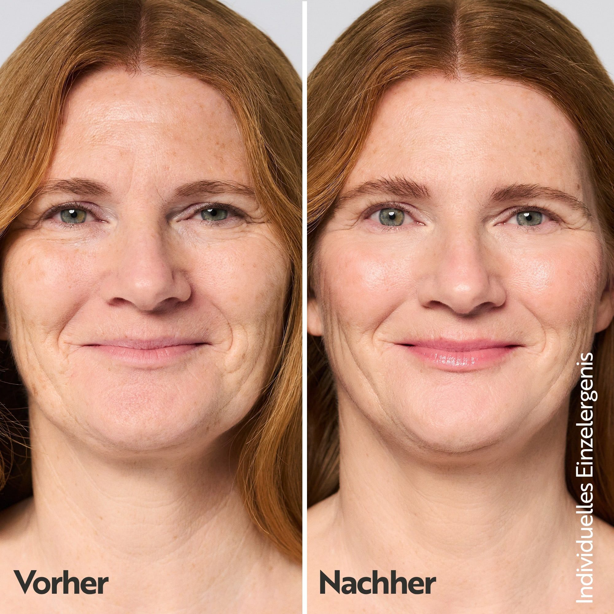 asambeauty Gesichtsserum Hautglättendes Serum – Bild 3 von 5