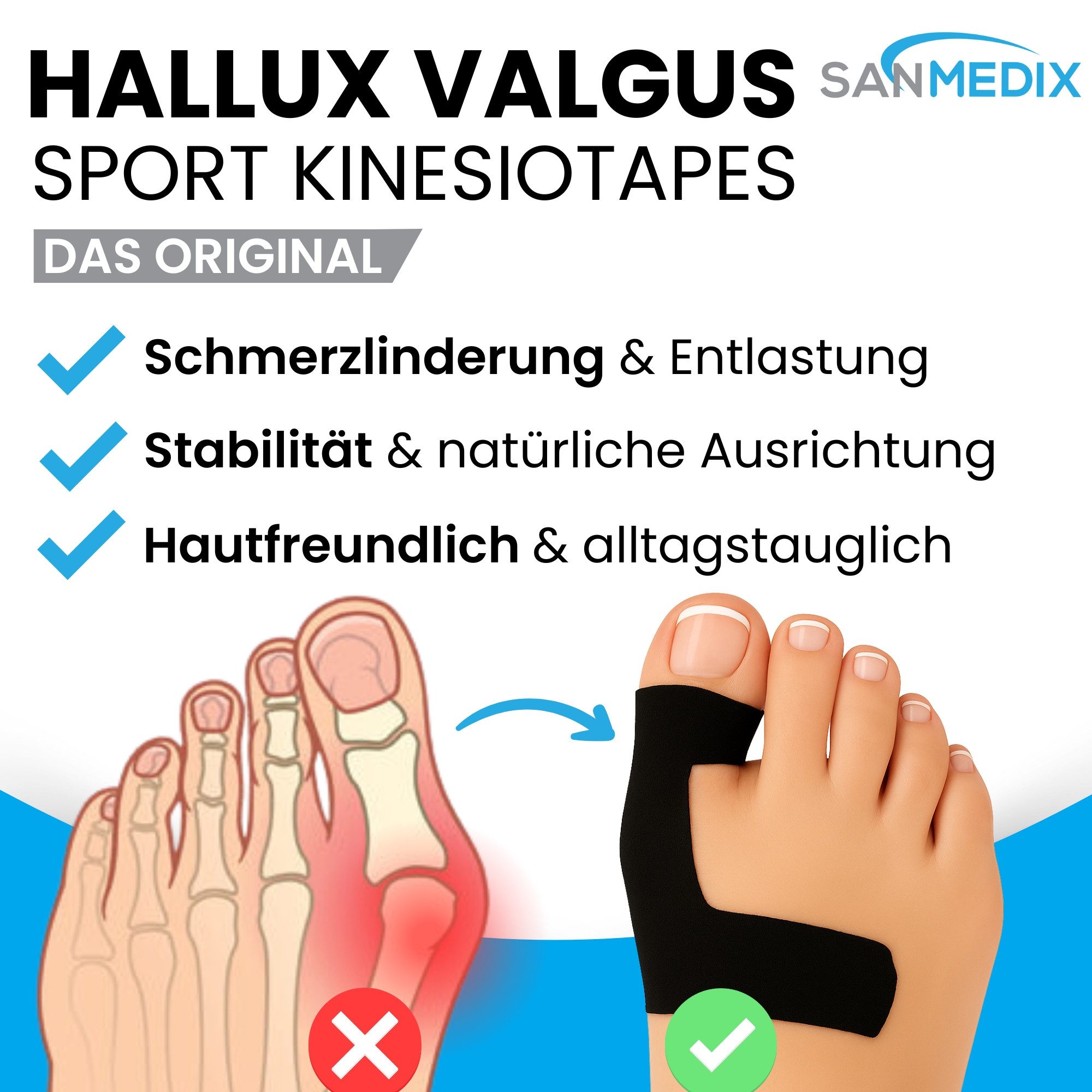 Sanmedix Kinesiologie-Tape Hallux Valgus Precut Kinesiotapes Vorgeschnitten bei Ballenzeh, atmungsaktiv, hautfreundlich, latexfrei