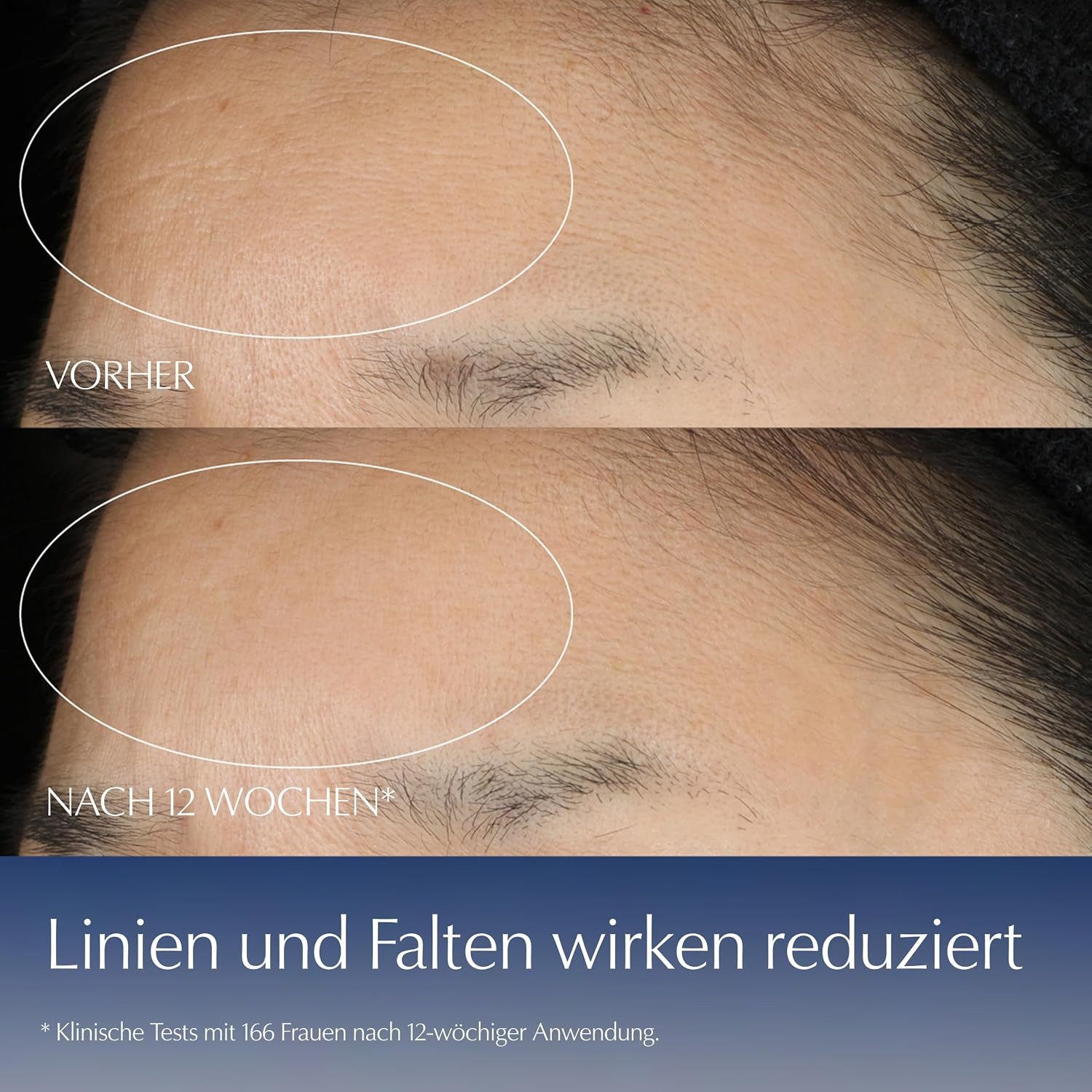 ESTÉE LAUDER Gesichtspflege Advanced Night Repair Synchronized Multi-Recovery Complex für glattere, strahlendere & ebenmäßigere Haut, Anti-Aging-Serum mit Tripeptide-32 und Hyaluronsäure