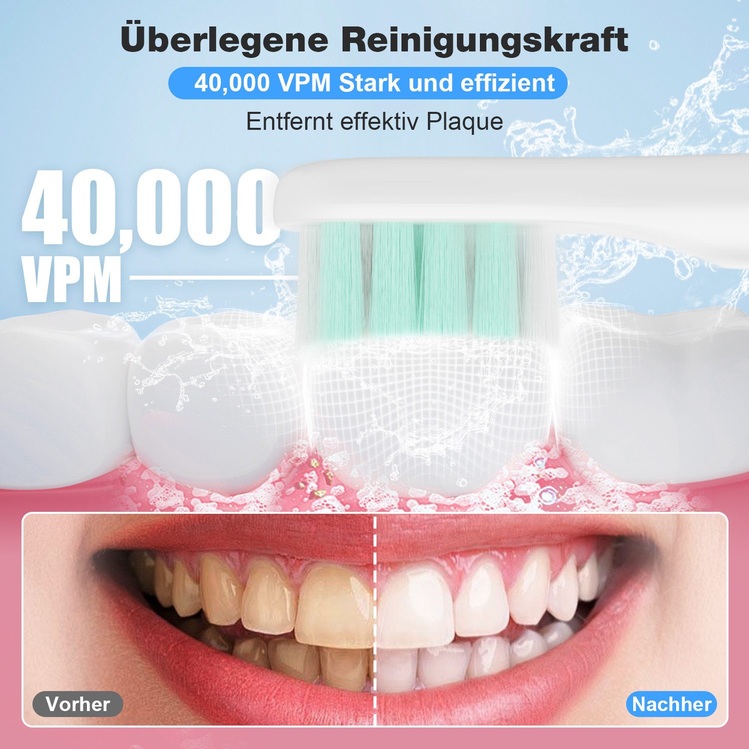 MCURO Schallzahnbürste Schallzahnbürste für Zahnpflege 40000 VPM, 5 Putzmodi, Aufsteckbürsten: 6 St., Reise Zahnbürsten,Timer,TYPE-C aufladbar
