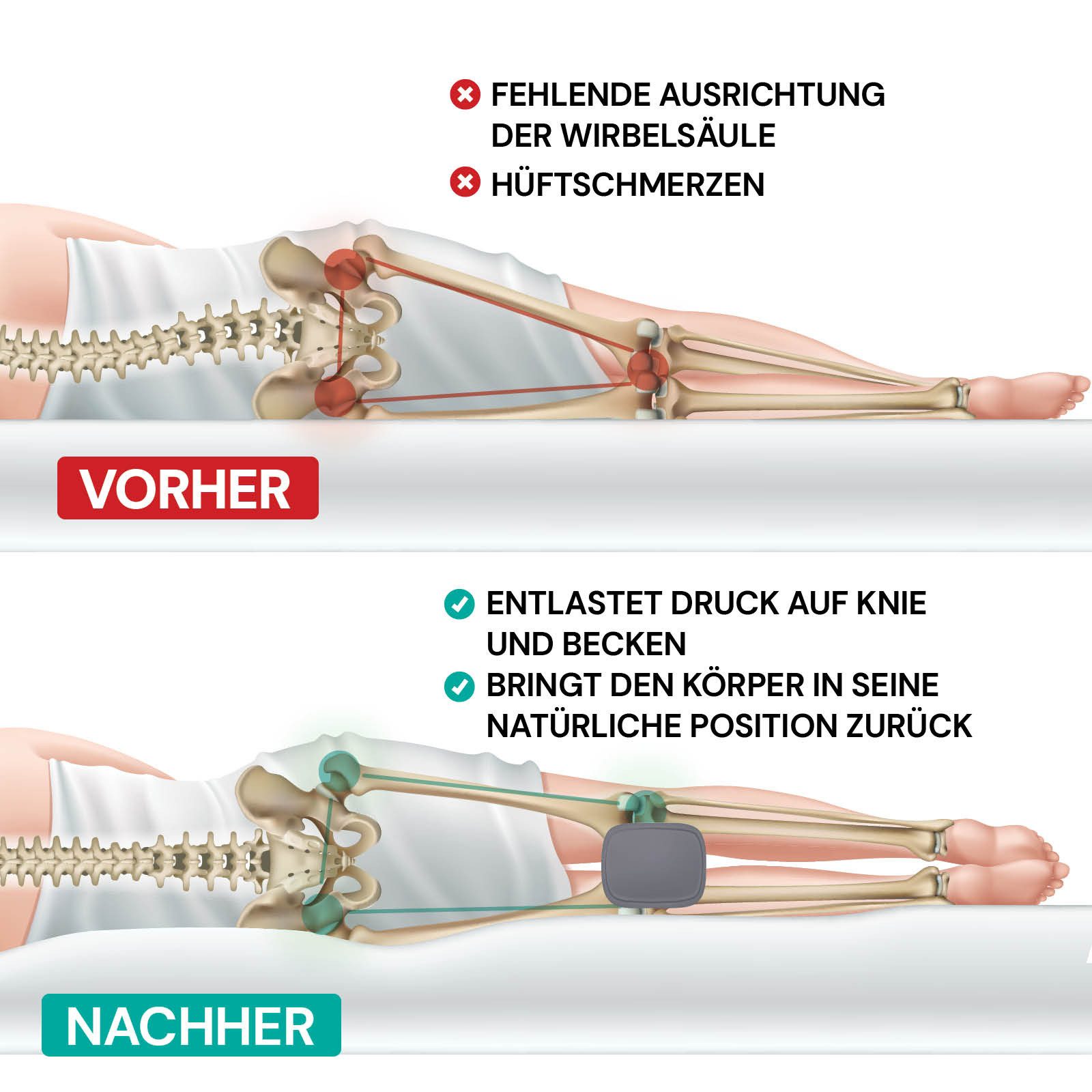 Vitapur Kniekissen Orthopädisches Kniekissen Seitenschläfer Memory Hüft & Rückenschmerzen