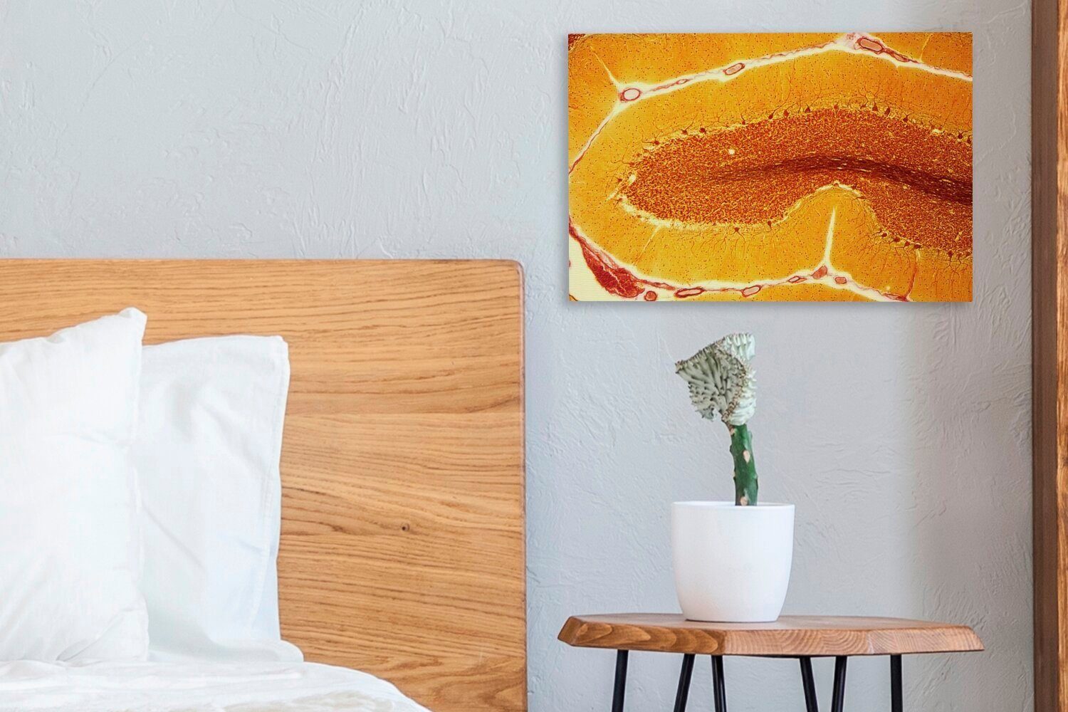 Wandbild Nerv, in Leinwandbild (1 cm einem Orangefarbene OneMillionCanvasses® Wanddeko, 30x20 St), Zellen Leinwandbilder, Aufhängefertig,