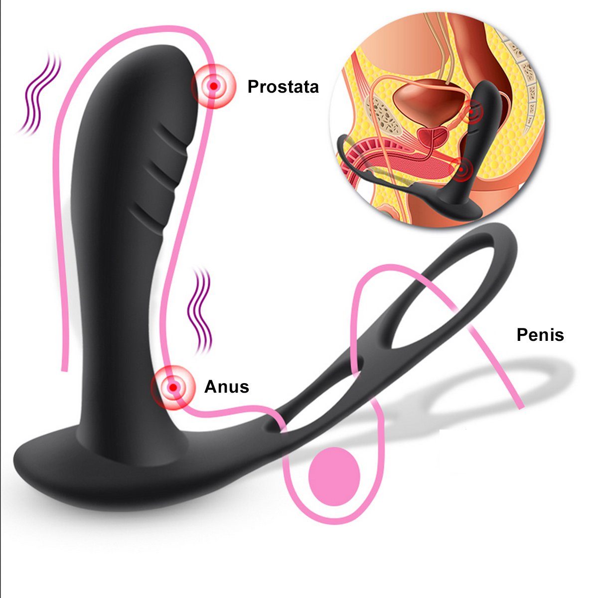 TPFSecret Analvibrator Vibrator verschiedene Fernbedienung Control ergonomischer Männer Anal Prostata Remote über USB Hodenring, Vibrationsmodi, für (10 ohne Penisring Anal Schwarz wiederaufladbar), ohne Vibrator und 