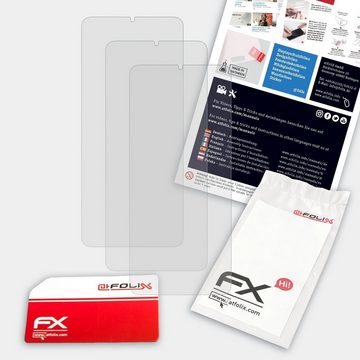 atFoliX Schutzfolie für Ulefone Note 10P, (3 Folien), Entspiegelnd und stoßdämpfend