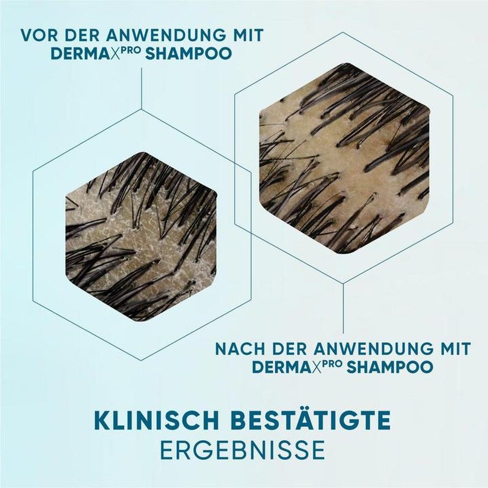Head & Shoulders Kopfhaut-Pflegeshampoo head&shoulders® DERMAXPRO HYDRA PFLEGE