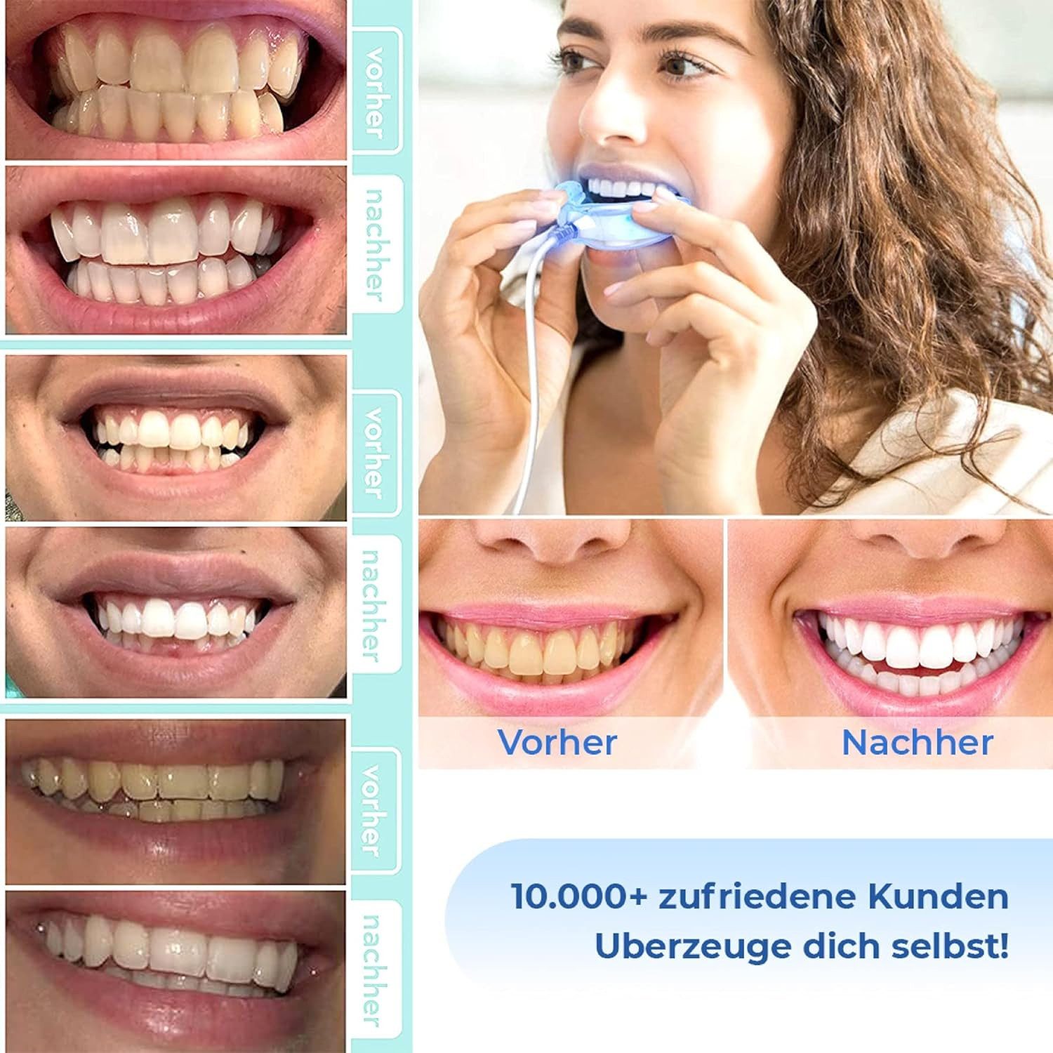 P-Beauty Cosmetic Accessories Zahnbleaching-Gel Zahnaufhellung Gel Stift Zahnweiß für weiße Zähne