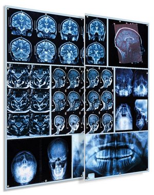 Wallario Sichtschutzzaunmatten Röntgen-Bilder eines menschlichen Kopfes von allen Seiten, 2-teilig