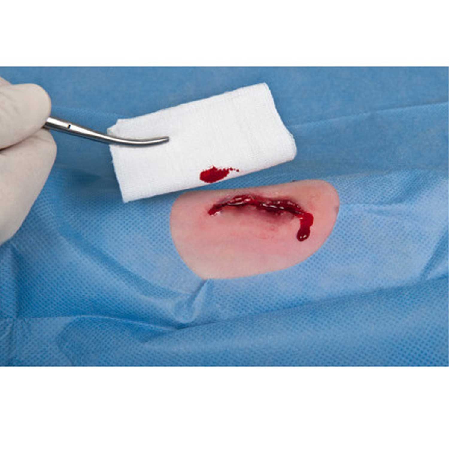 Nobamed Erste-Hilfe-Set Mullkompresse-steril, 8-fach, à 2 - 10x10 cm