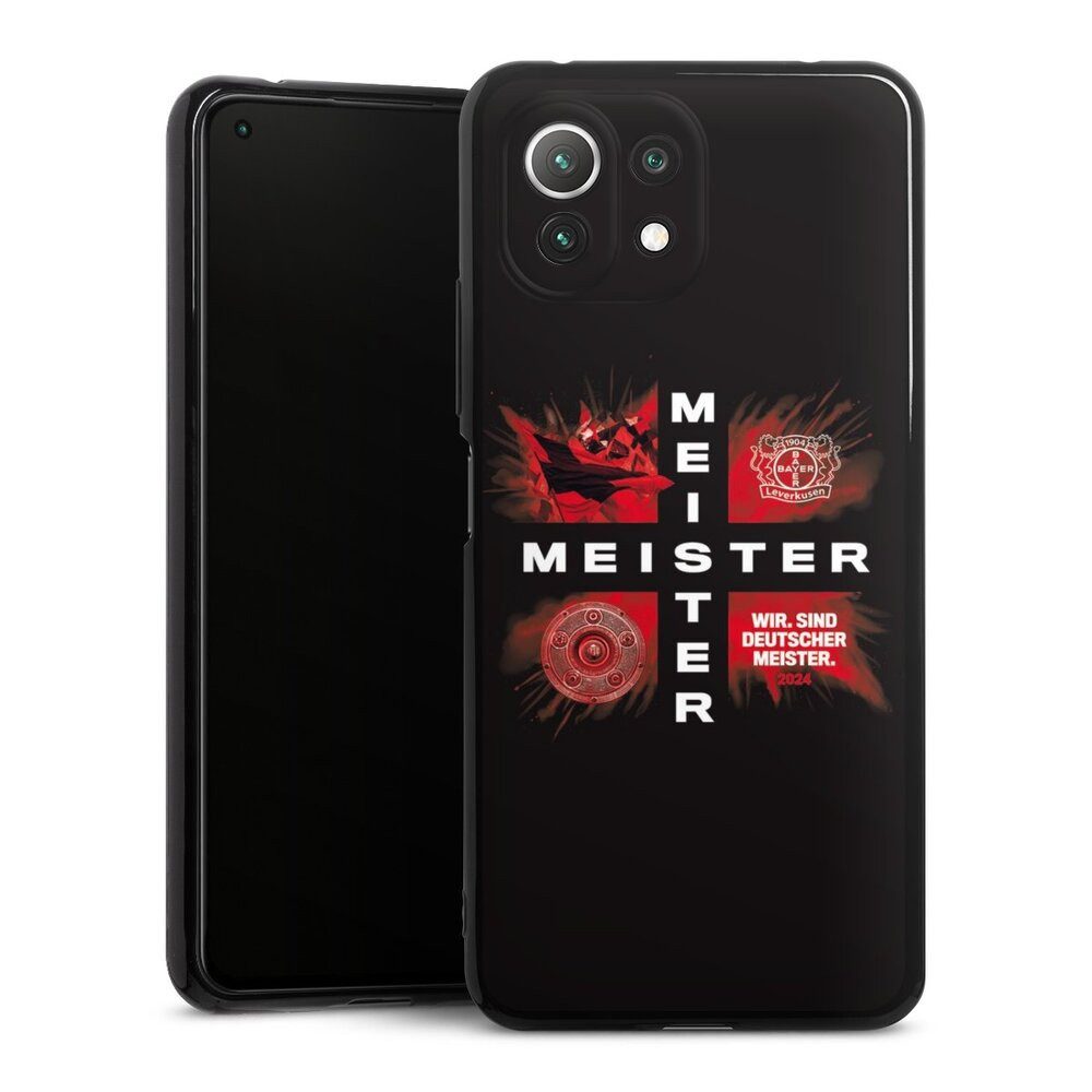 DeinDesign Handyhülle Bayer 04 Leverkusen Meister Offizielles Lizenzprodukt, Xiaomi Mi 11 Lite 5G Silikon Hülle Bumper Case Handy Schutzhülle