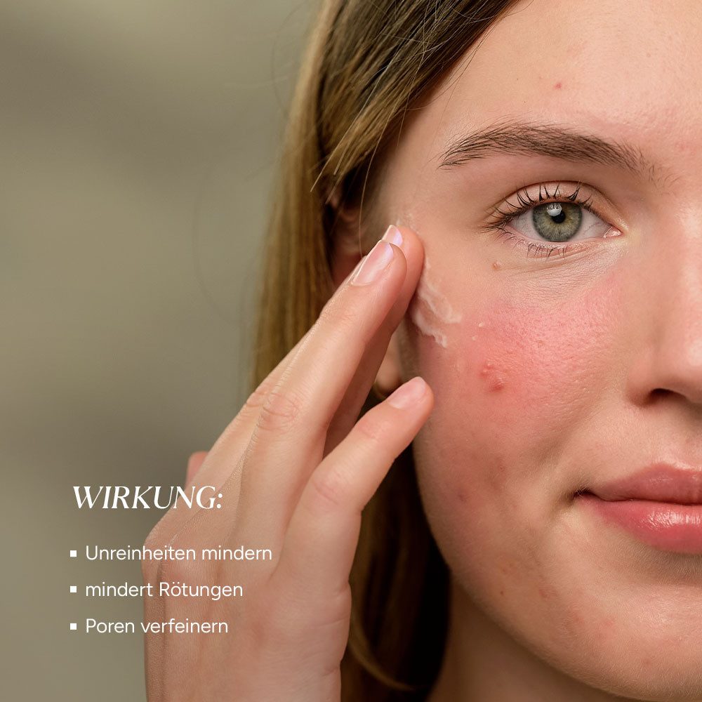 JUNGLÜCK Gesichtsserum Azelain Serum - 10% azelaic acid, 1-tlg., Wirkt gezielt gegen Unreinheiten