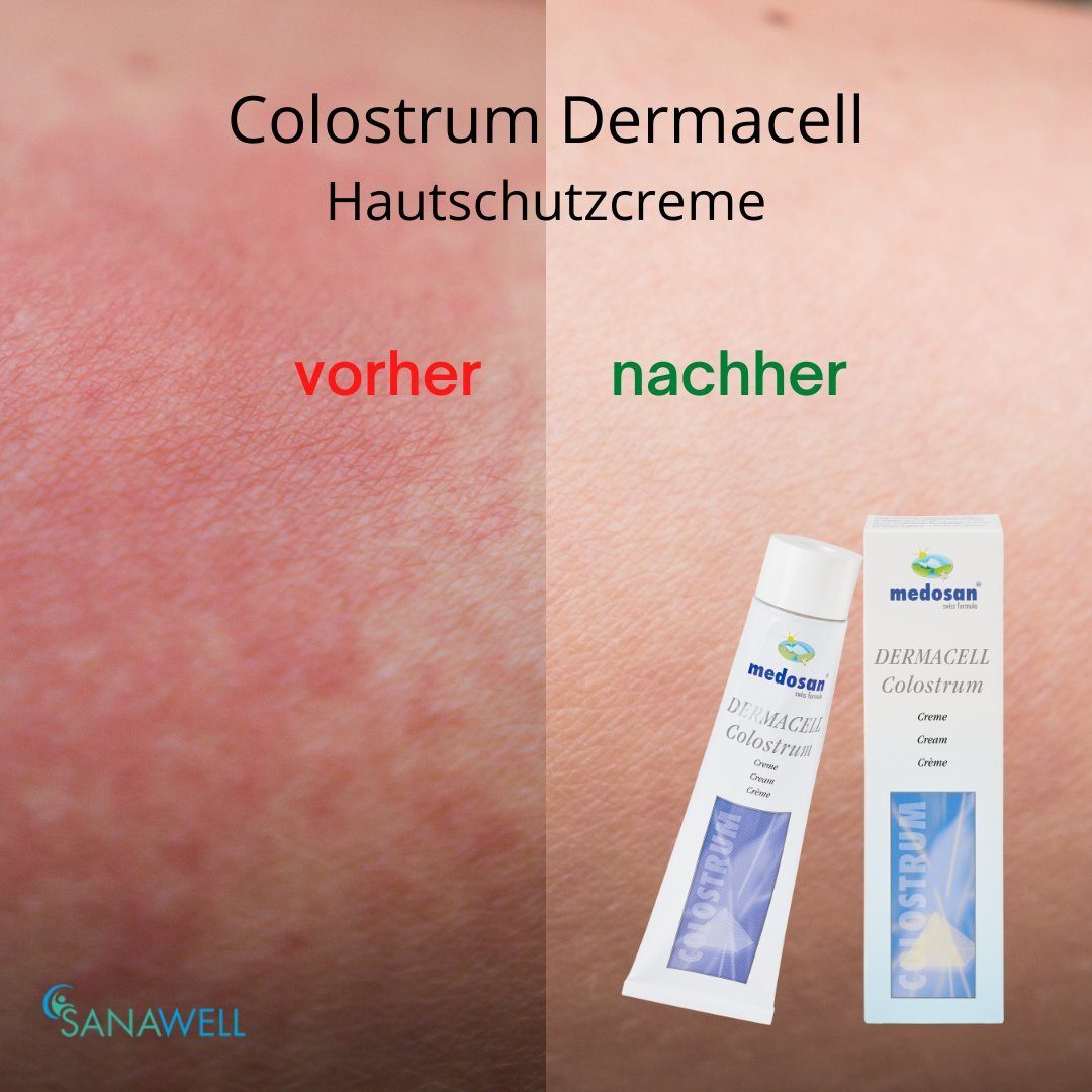 Medosan Hautcreme Medosan DermaCell Colostrum Creme für die regenerative Hautpflege