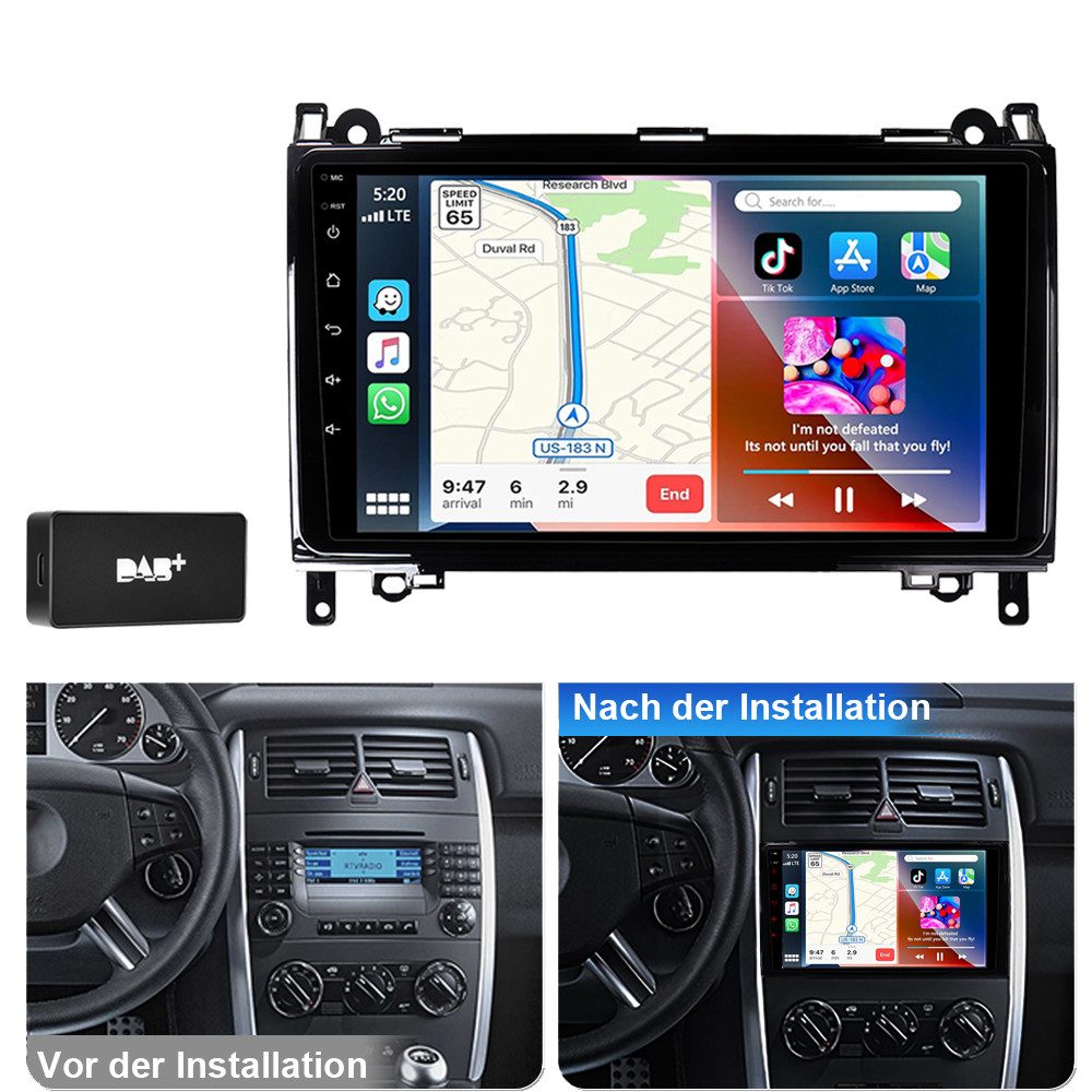 A-Sure Android 15 Carplay Für Mercedes-Benz A/B KlasseW169 W639 W245 W906 Autoradio (Digitalradio (DAB), FM, AM, 1280*800 IPS Screen)