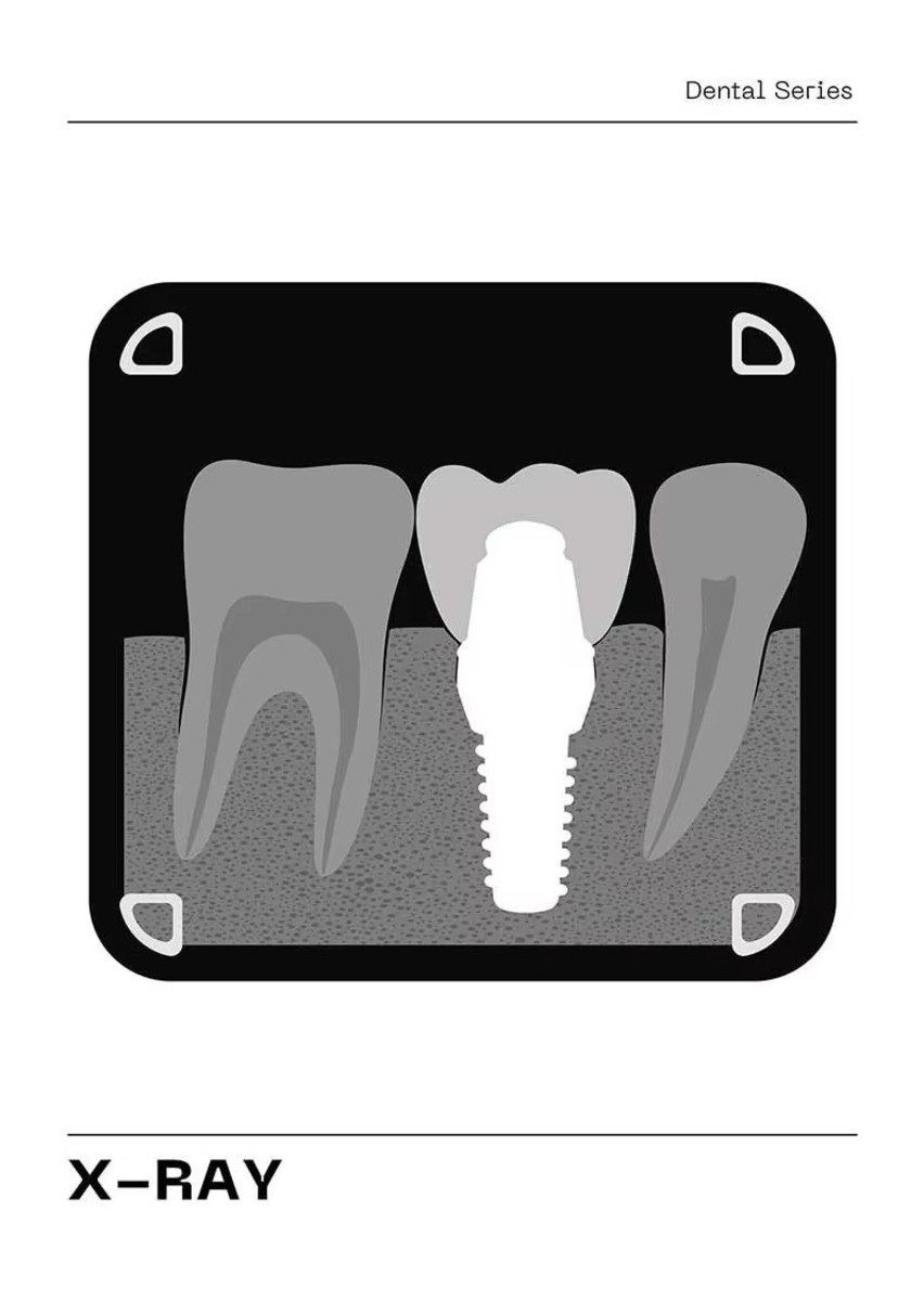 TPFLiving Kunstdruck (OHNE RAHMEN) Poster - Leinwand - Wandbild, Oral Zahn Anatomie Zahnpflege Checkup Poster Leinwand (Leinwandbild XXL), Farben: Grau, Rot, Weiß, Schwarz, Blau, Braun -Größe: 20x30cm