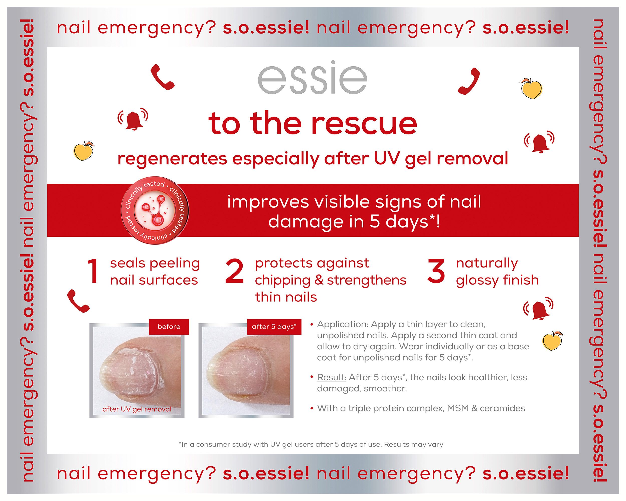 essie Nagelhautpflege Essie nail rescue Kit, 2-tlg.