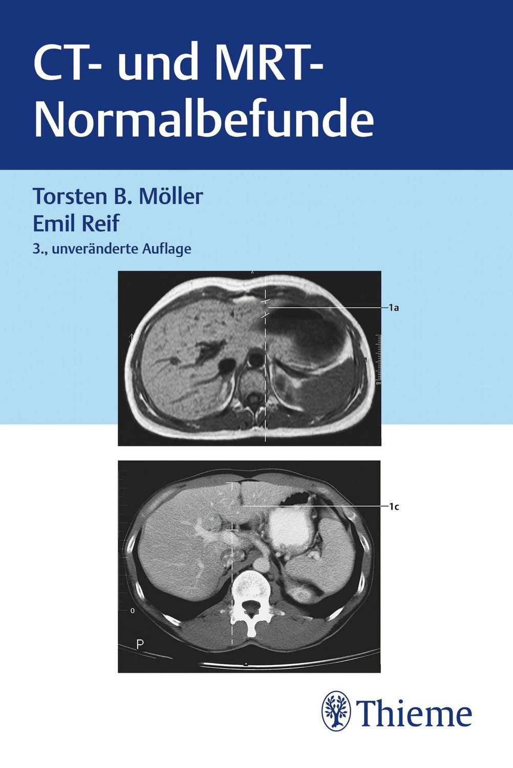CT und MRT Normalbefunde / Torsten Bert Möller, Emil Reif
