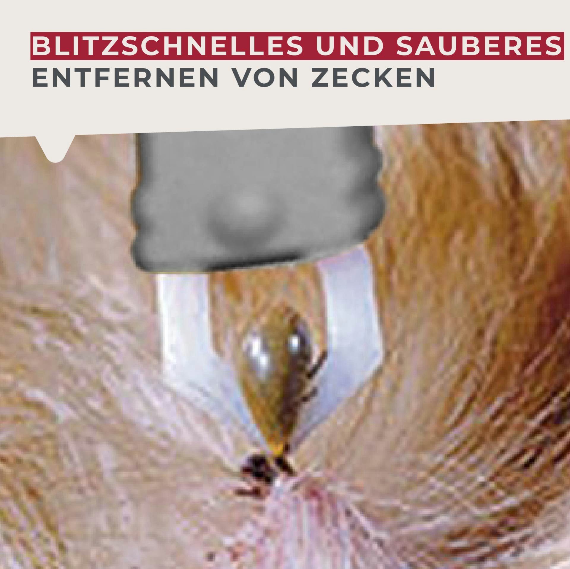 FACKELMANN Zeckenpinzette Zeckenzange, Zeckenentferner, Zeckenpinzette, Zeckenhilfe