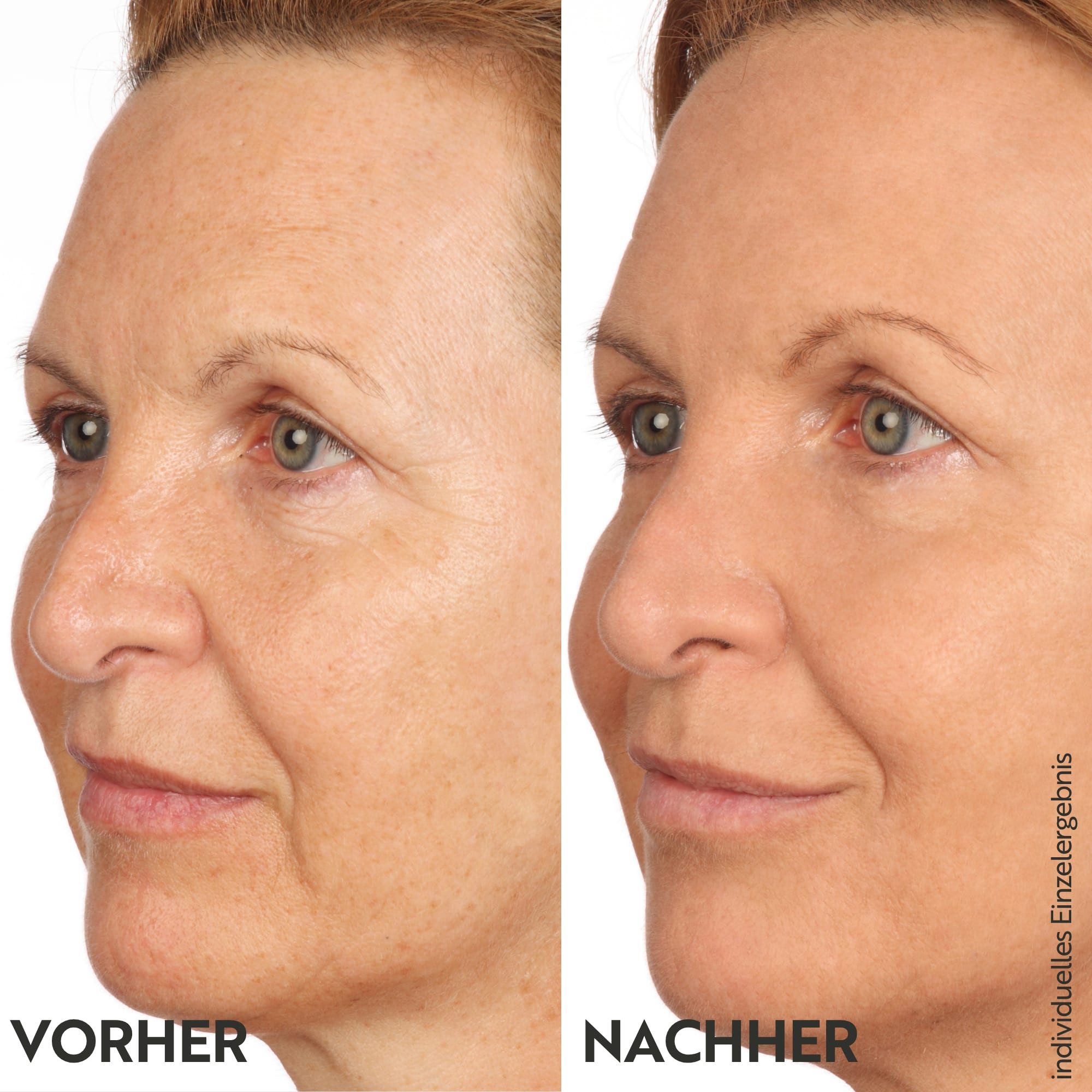 asambeauty Getönte Gesichtscreme Getönte Straffungscreme