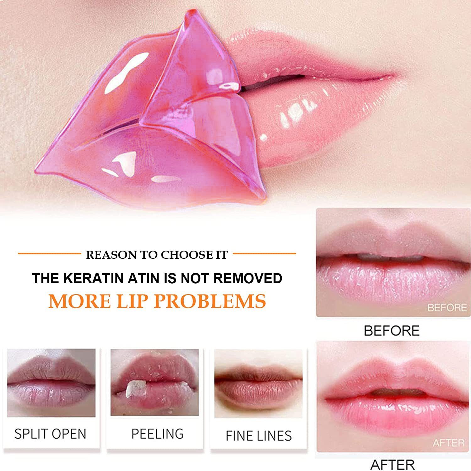 COOL-i ® Lippenpflegestift, Anti-Aging Cherry Feuchtigkeitsgel Lippenmaske, Anti-Aging-Feuchtigkeitsgel-Lippenmaske für trockene und rissige Lippen - 20 Stück