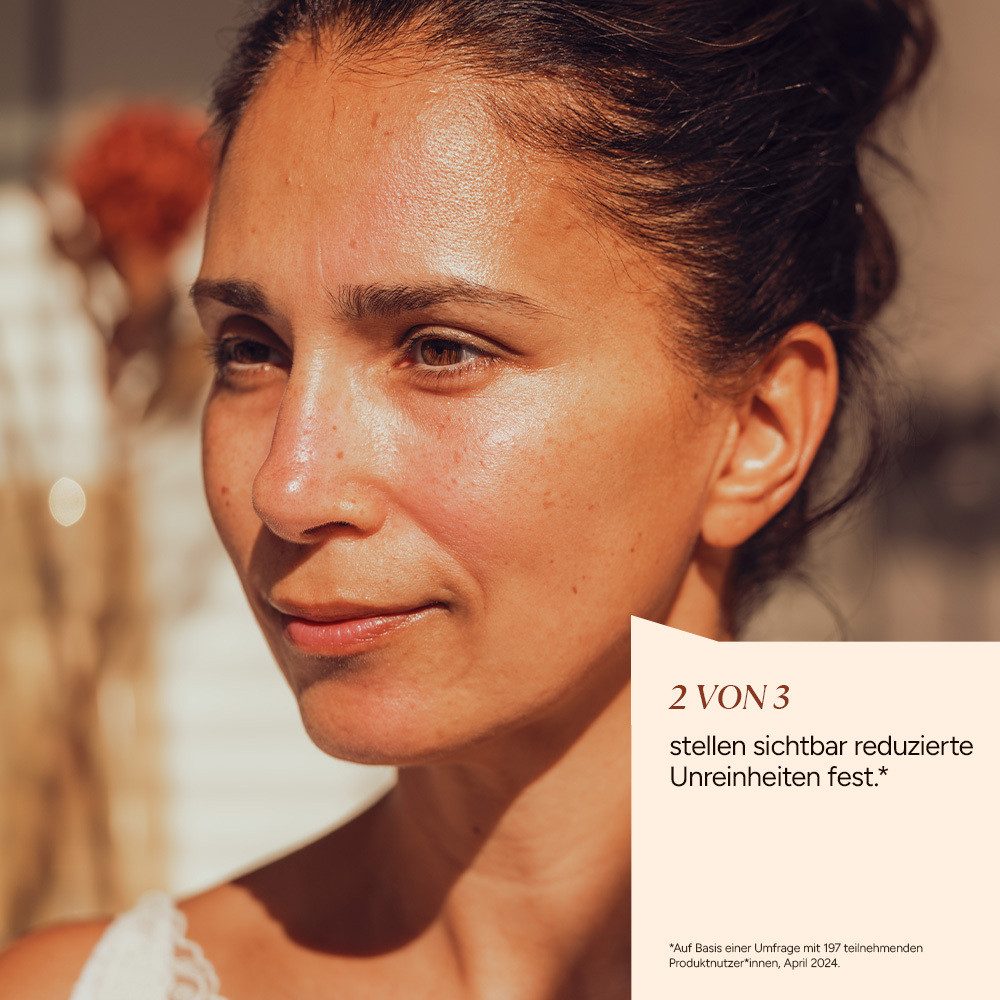 JUNGLÜCK Gesichtswasser Zink Toner - Mit Zink & Niacinamid, 1-tlg., Klärt und verbessert das Hautbild besonders bei öliger & unreiner Haut