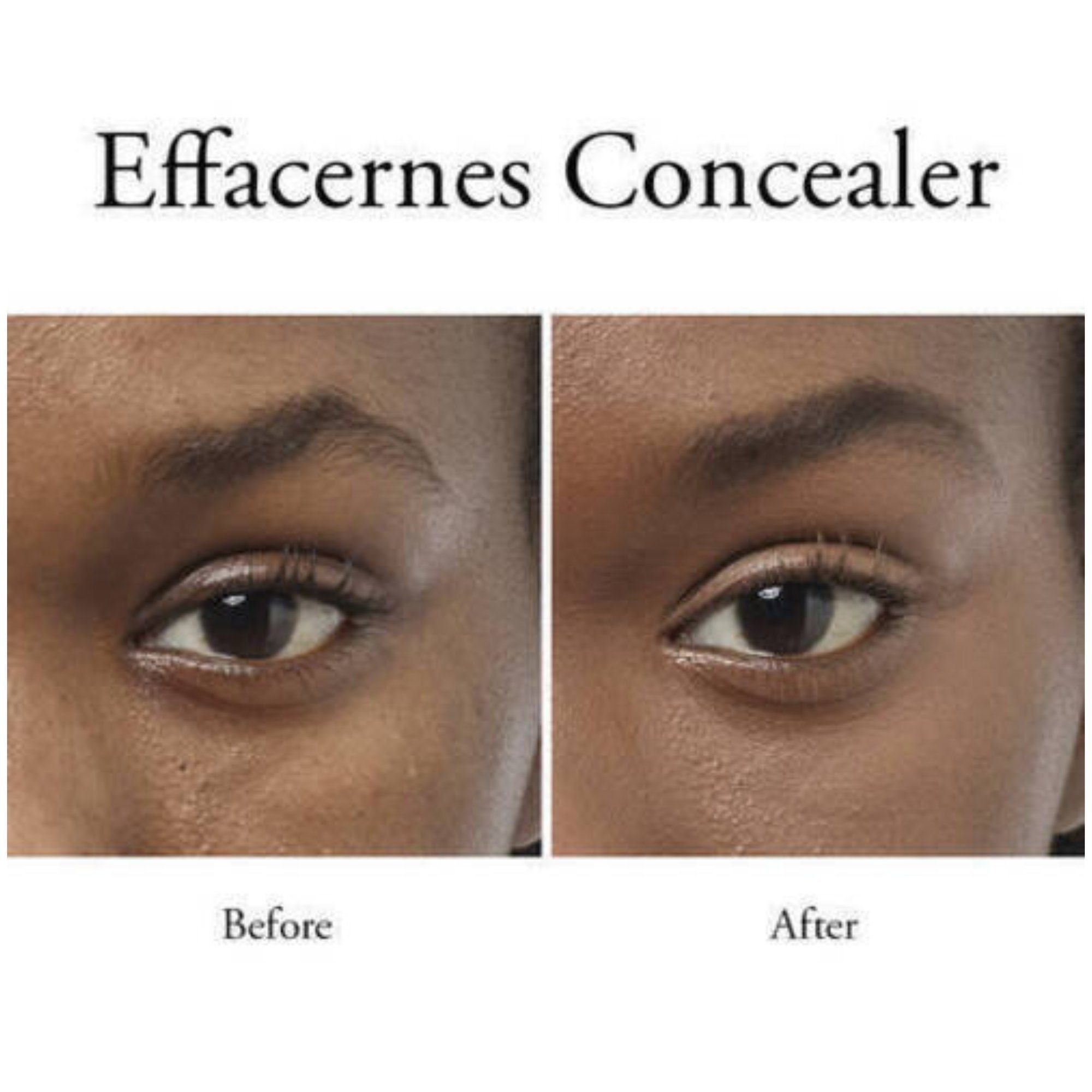 LANCOME Concealer Effacernes Waterproof Long-Lasting Undereye Concealer 310 Camee, 14 gr