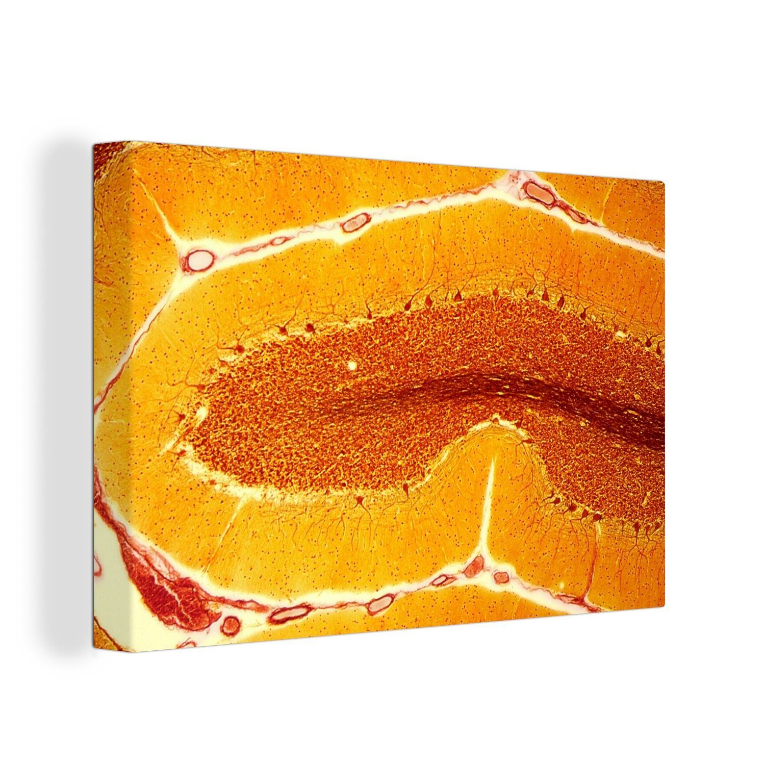 OneMillionCanvasses® Leinwandbild Orangefarbene Zellen in einem Nerv, (1 St), Wandbild Leinwandbilder, Aufhängefertig, Wanddeko, 30x20 cm