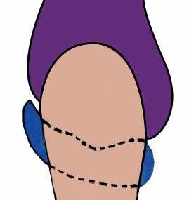 Hydas Beckenbodentrainer für eine kräftige Becken- und Unterleibsmuskulatur, Eine Trainingsmethode zum Vorbeugen und Verbessern von Blasenschwäche