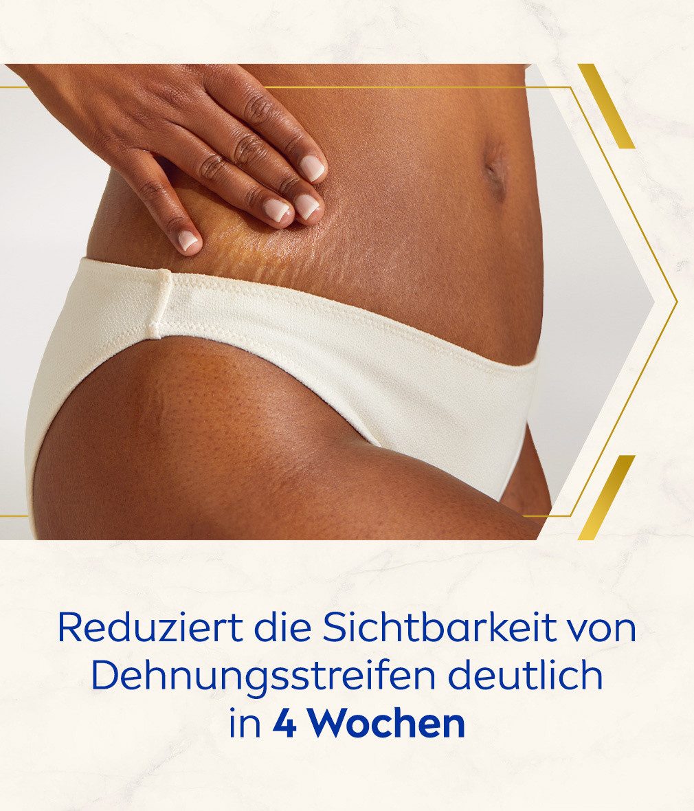 Nivea Körpercreme Anti-Dehnungsstreifen + Pigmentflecken LUMINOUS630® 2 x 200ml Packung, 2-tlg., Luminous630®