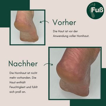 Fußkundig Fußschaum Fuß-Spezial Pflegeschaum gegen Hornhaut & Schrunden