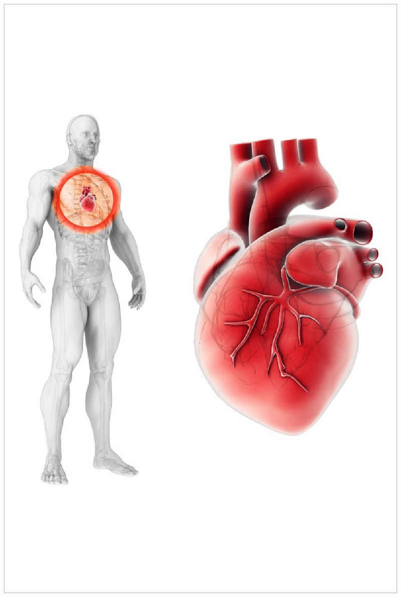 Wallario Poster, Anatomie des Menschen  Herz in Nahansicht, in verschiedenen Ausführungen