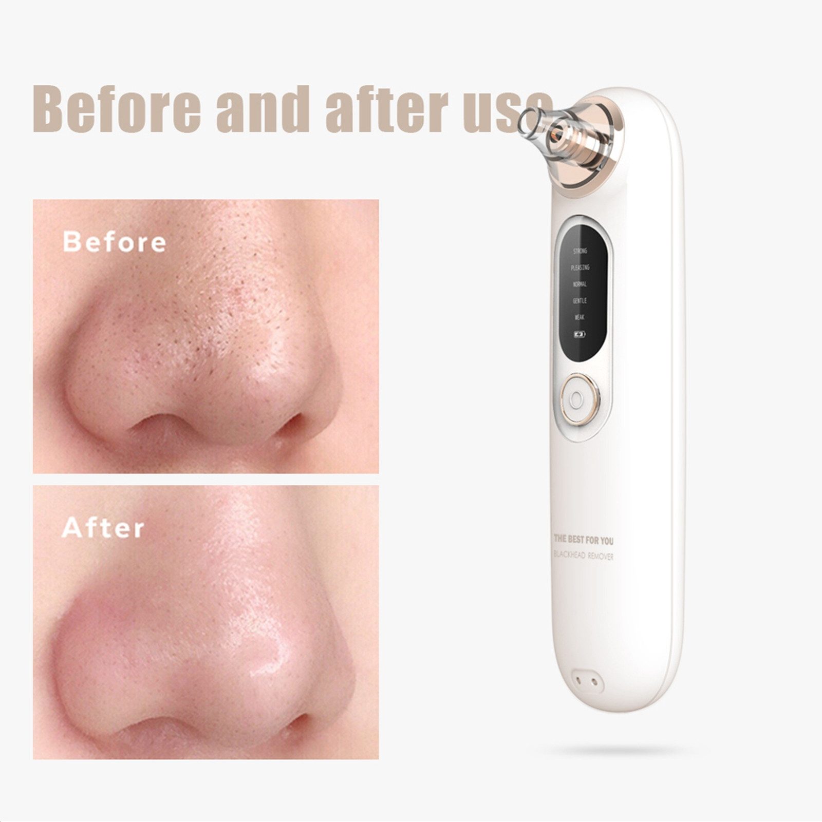 POPOLIC Mitesserentferner Porenreiniger Gesicht Porensauger Pickelentferner, Sauger Akne Entferner mit 5 Modi & 4 Saugspitzen, Gesichtsreinigung Pickesauger Akne Entferner Gerät Blackhead Remover