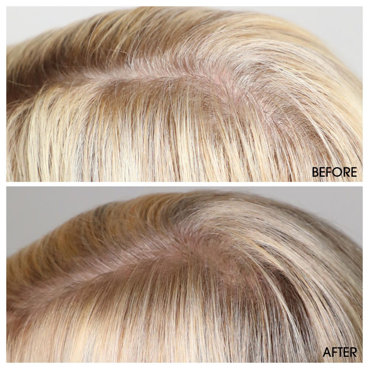 M2 Beauté Haaröl Hair Activating Serum, Alle Hauttypen