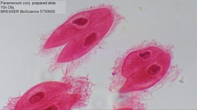 Bresser Mikroskop Bioscience 40-1000x Trinokulares Trinokulares Trinokulares Mikroskop online kaufen 97c393 Bresser Mikroskop Bioscience 40-1000x Trinokulares Trinokulares Trinokulares Mikroskop online kaufen 97c393