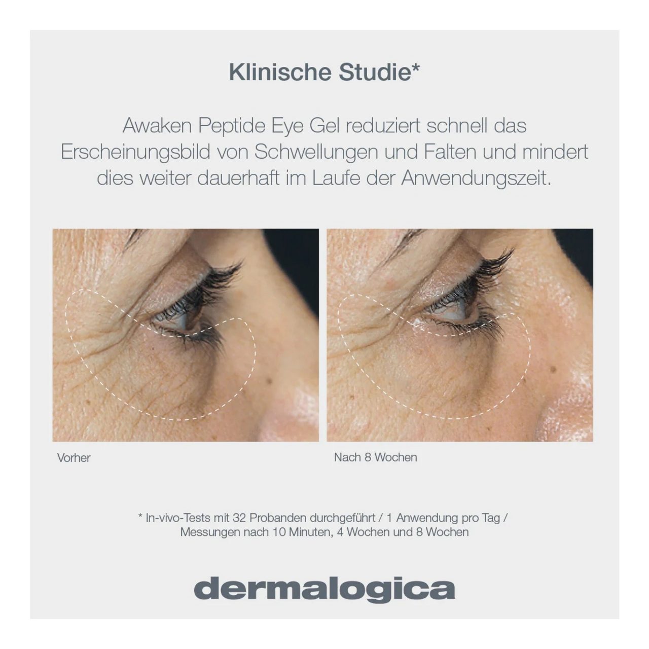 Dermalogica Augengel Awaken Peptide Eye Gel, für Alle Hauttypen
