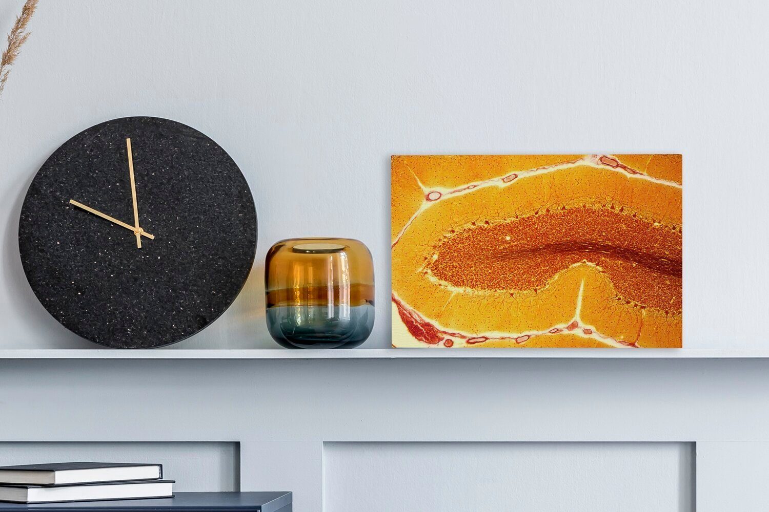 Wandbild Nerv, in Leinwandbild (1 cm einem Orangefarbene OneMillionCanvasses® Wanddeko, 30x20 St), Zellen Leinwandbilder, Aufhängefertig,