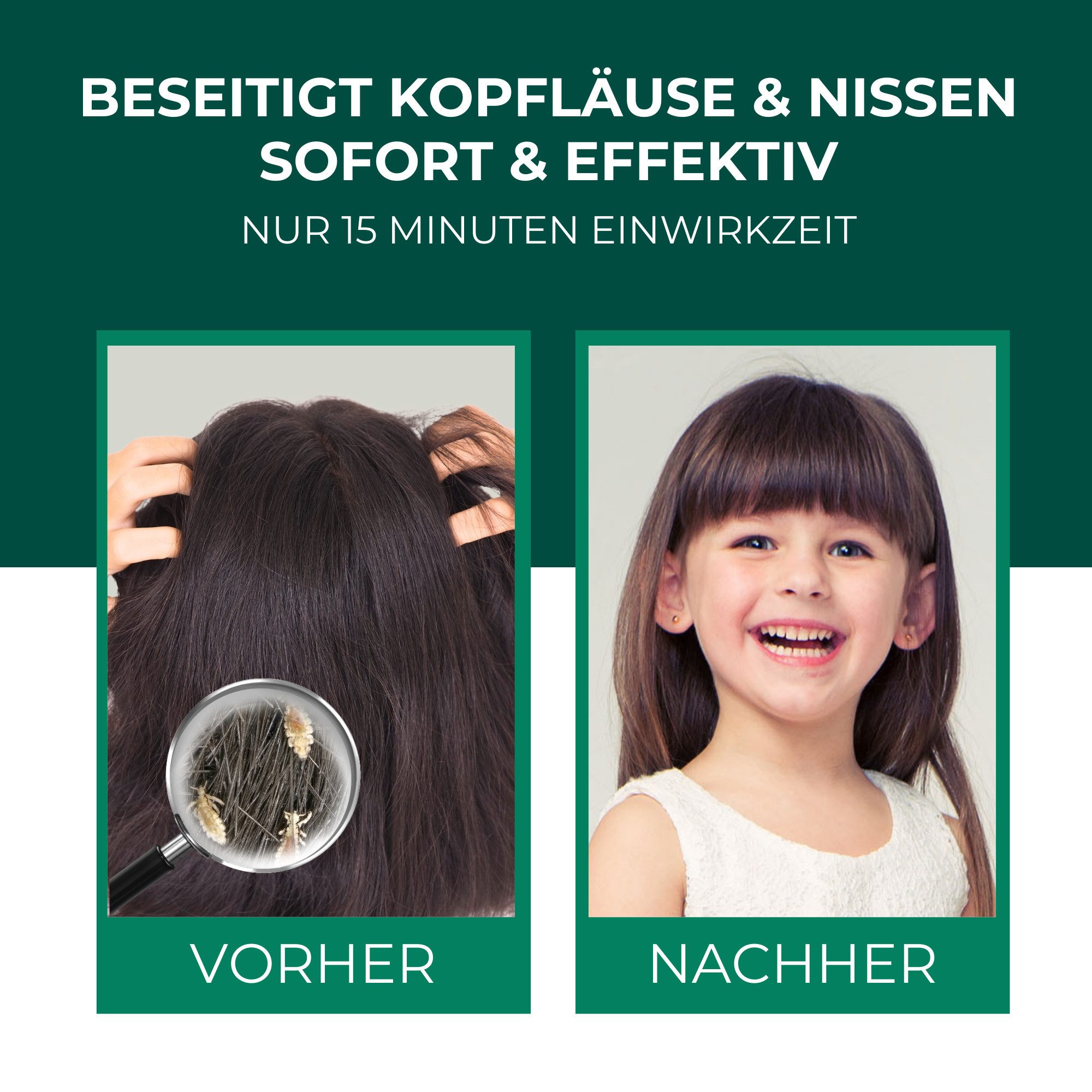 Silberkraft Kopfhaut-Pflegeshampoo Kopfläuse-Shampoo - Läuseshampoo für Kinder & Erwachsene, Geruchsneutral, Ohne Parabene, Parfüm- und Duftstoffe, Die hochwirksame 2-Phasen-Lösung gegen Kopfläuse, inkl. Nissenkamm - Nur 15 Min Einwirkzeit - für Kinder ab 1 Jahr