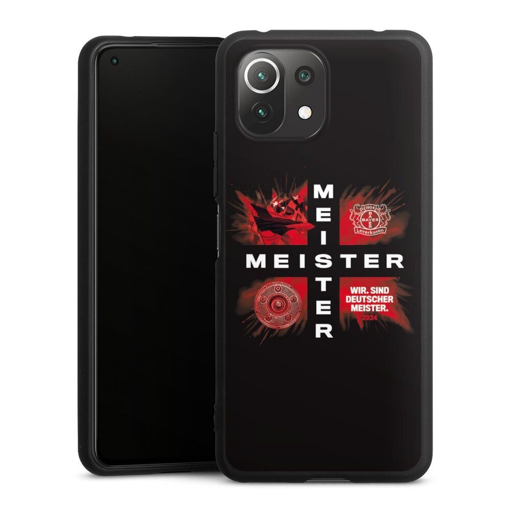DeinDesign Handyhülle Bayer 04 Leverkusen Meister Offizielles Lizenzprodukt, Xiaomi Mi 11 Lite 5G Silikon Hülle Premium Case Handy Schutzhülle