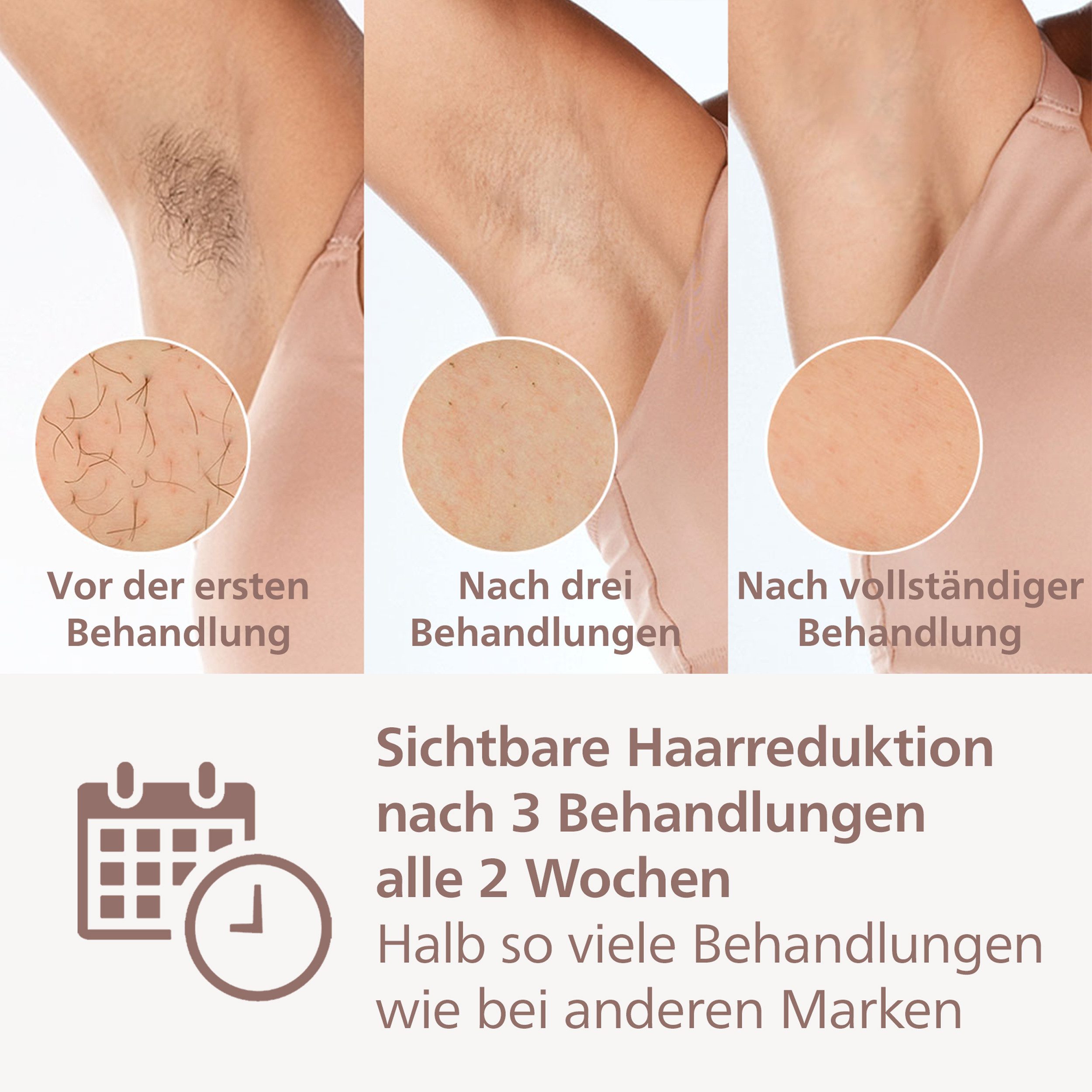 Philips IPL-Haarentferner Philips Lumea Series 8000 BRI947/00, 450.000 Lichtimpulse, 4 Aufsätze (Achseln, Bikinizone, Körper und Gesicht) weiß