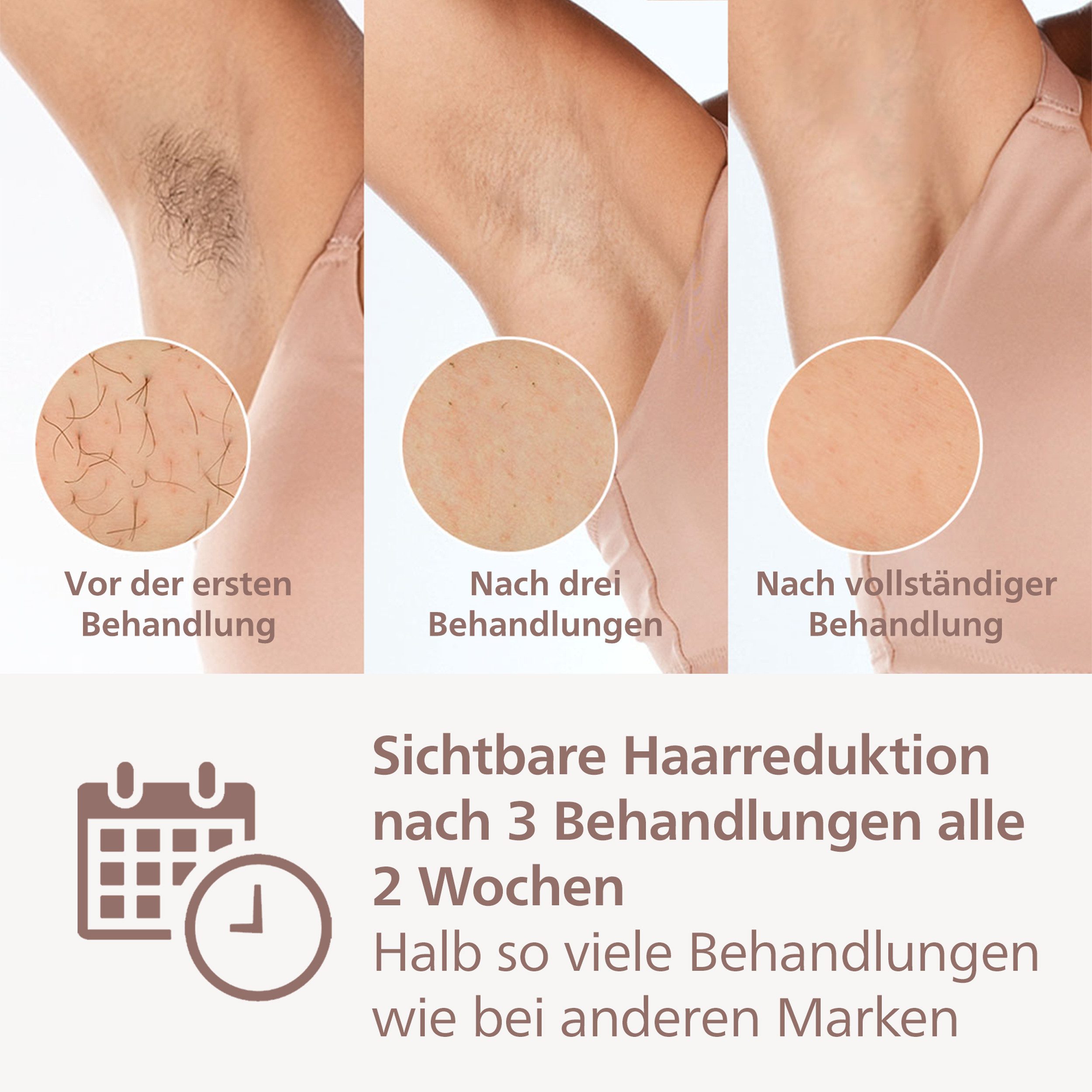 Philips IPL-Haarentferner Philips Lumea S9000 BRI955/00, 450.000 Lichtimpulse, 3 Aufsätze (Körper, Gesicht und Präzisionsaufsatz), kabellos goldfarben|weiß