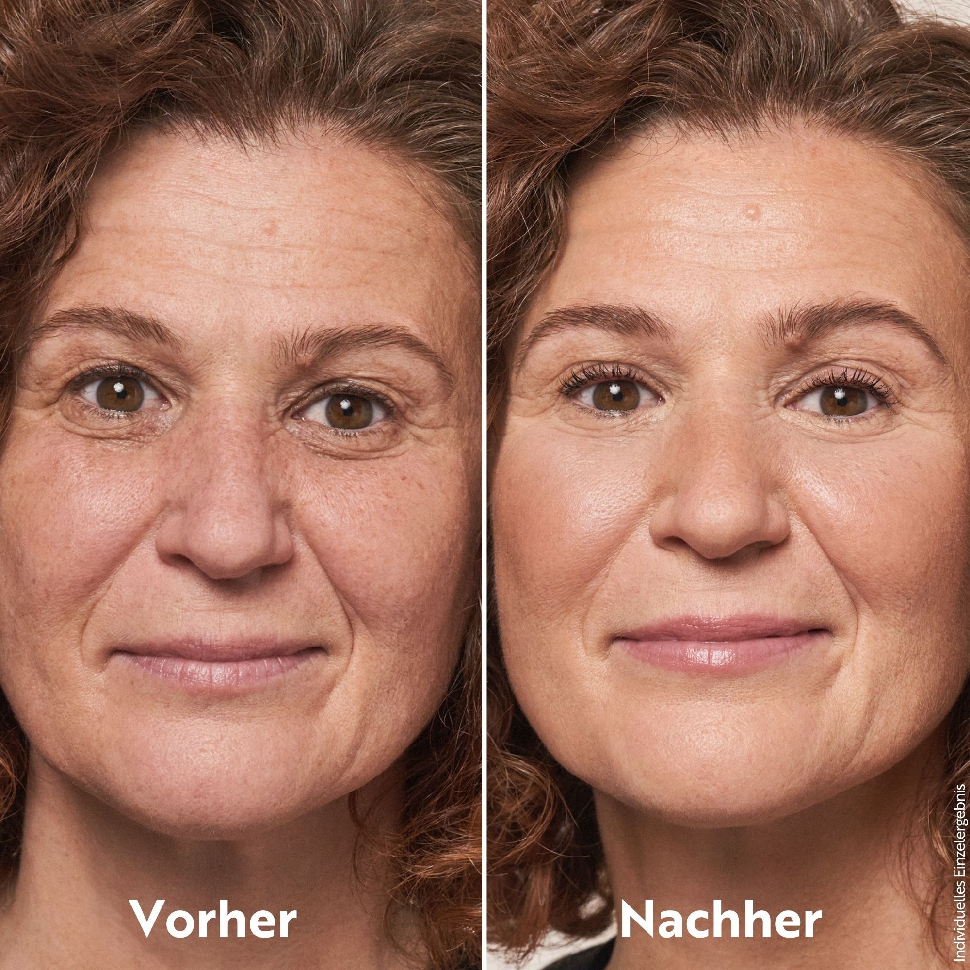 asambeauty Concealer M. Asam MAGIC FINISH HIGHCLASS LIQUID CONCEALER Nude (4ml)