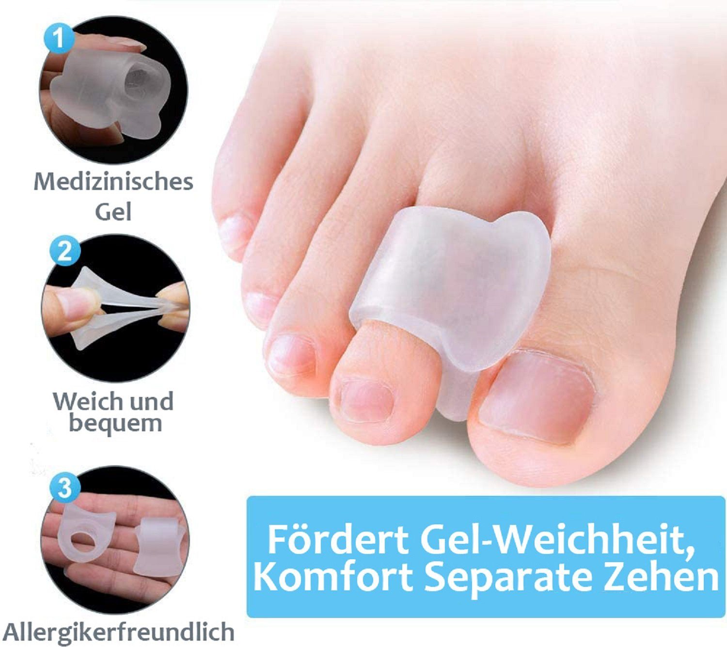 Zehentrenner-Ärmel 2 Paar – Weicher Gel-Abstandshalter, Zur Korrektur Von Ballenzehen, Hammerzehen & überlappenden Zehen, Hautfarben