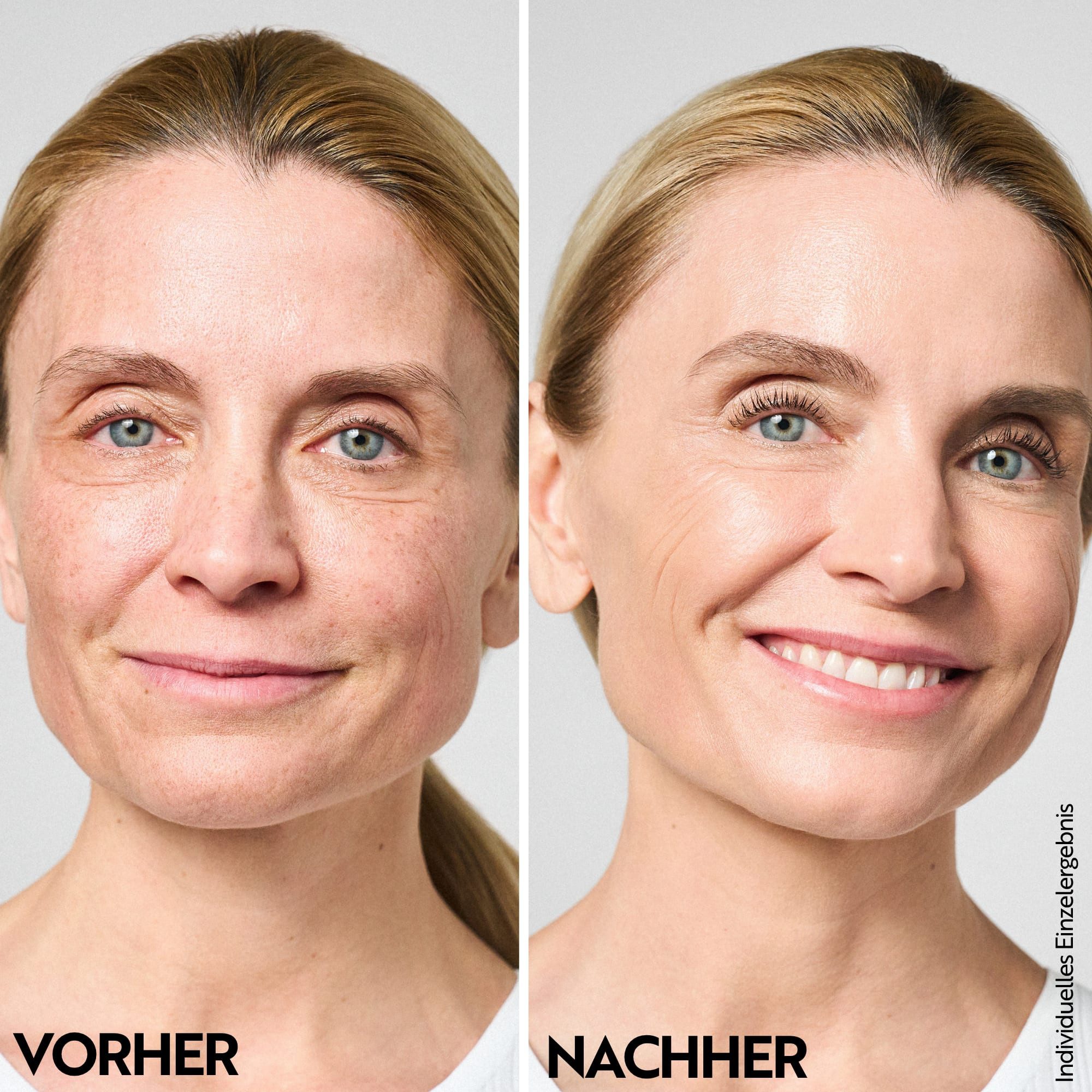 asambeauty Getönte Gesichtscreme Getönte Hyaluron Tagescreme