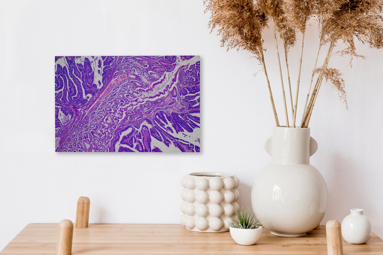 OneMillionCanvasses® Leinwandbild Bakterien, Aufhängefertig, Wanddeko, St), 30x20 Wandbild Leinwandbilder, (1 cm
