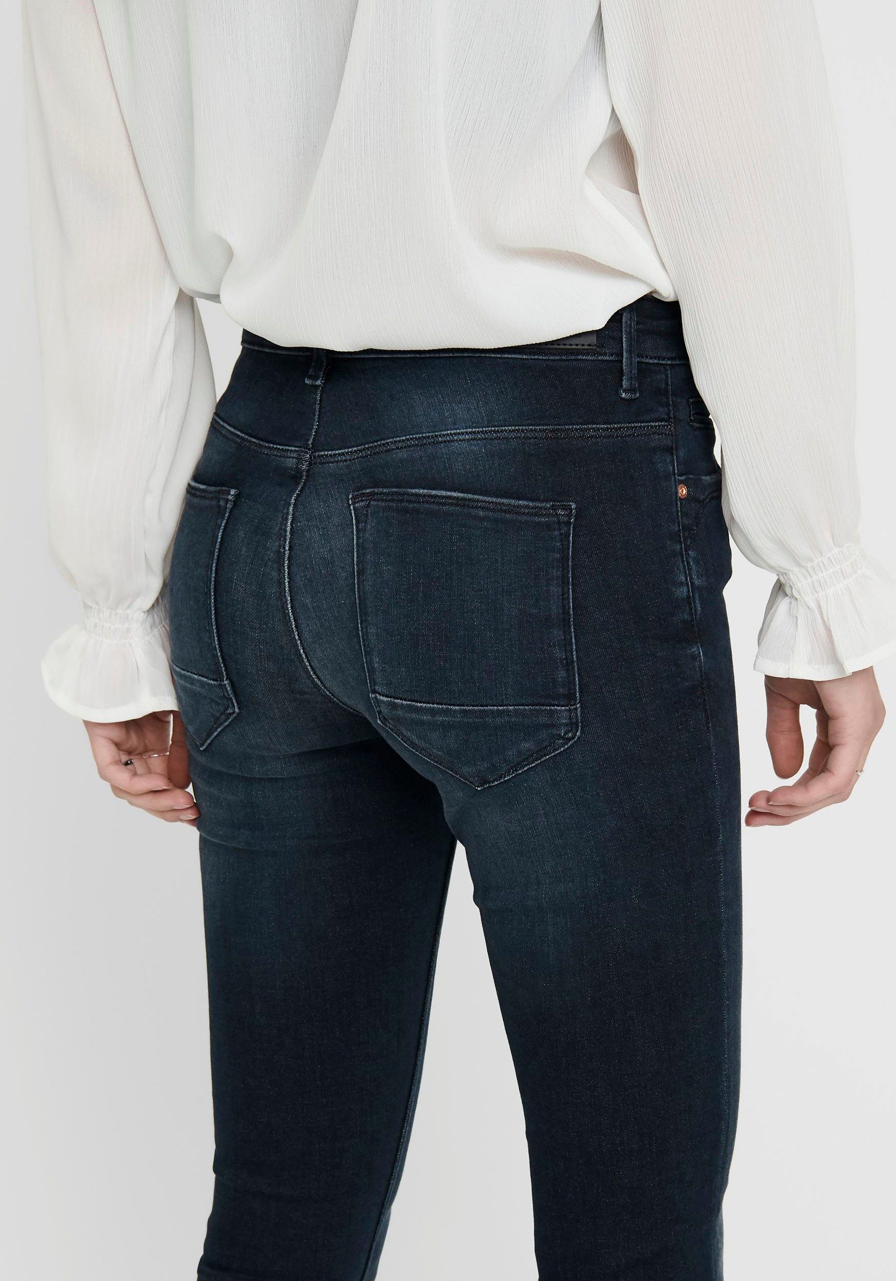 S/34 cm am mit Zipper REG Innenbeinlänge: Skinny-fit-Jeans SK LIFE Größe in Saum, ca. ANKLE 84 ONLY ONLKENDELL