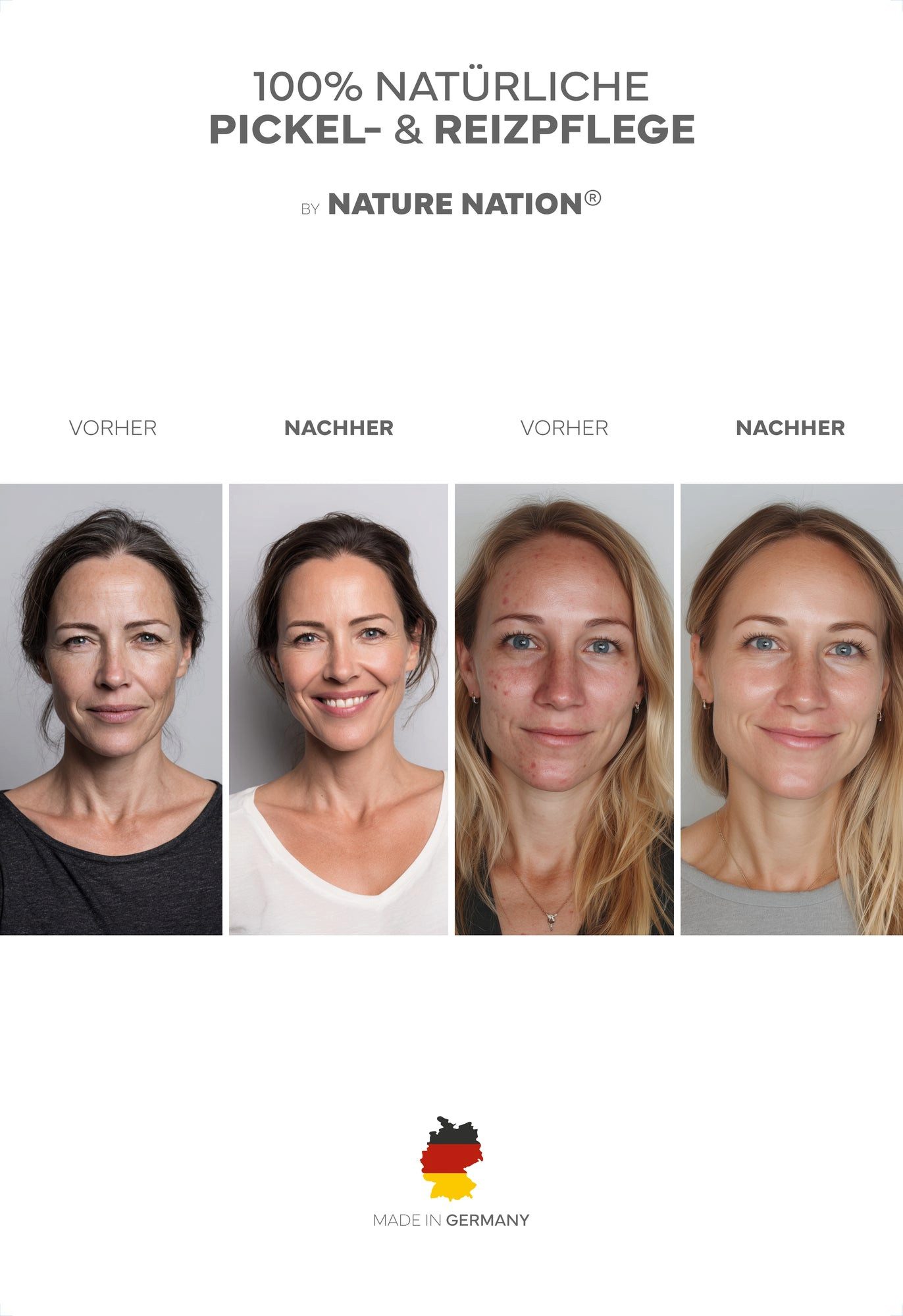 NATURE NATION Körperpflegemittel BIO Zink Gesichtswasser Spray mit Niacinamid & Aloe Vera Packung